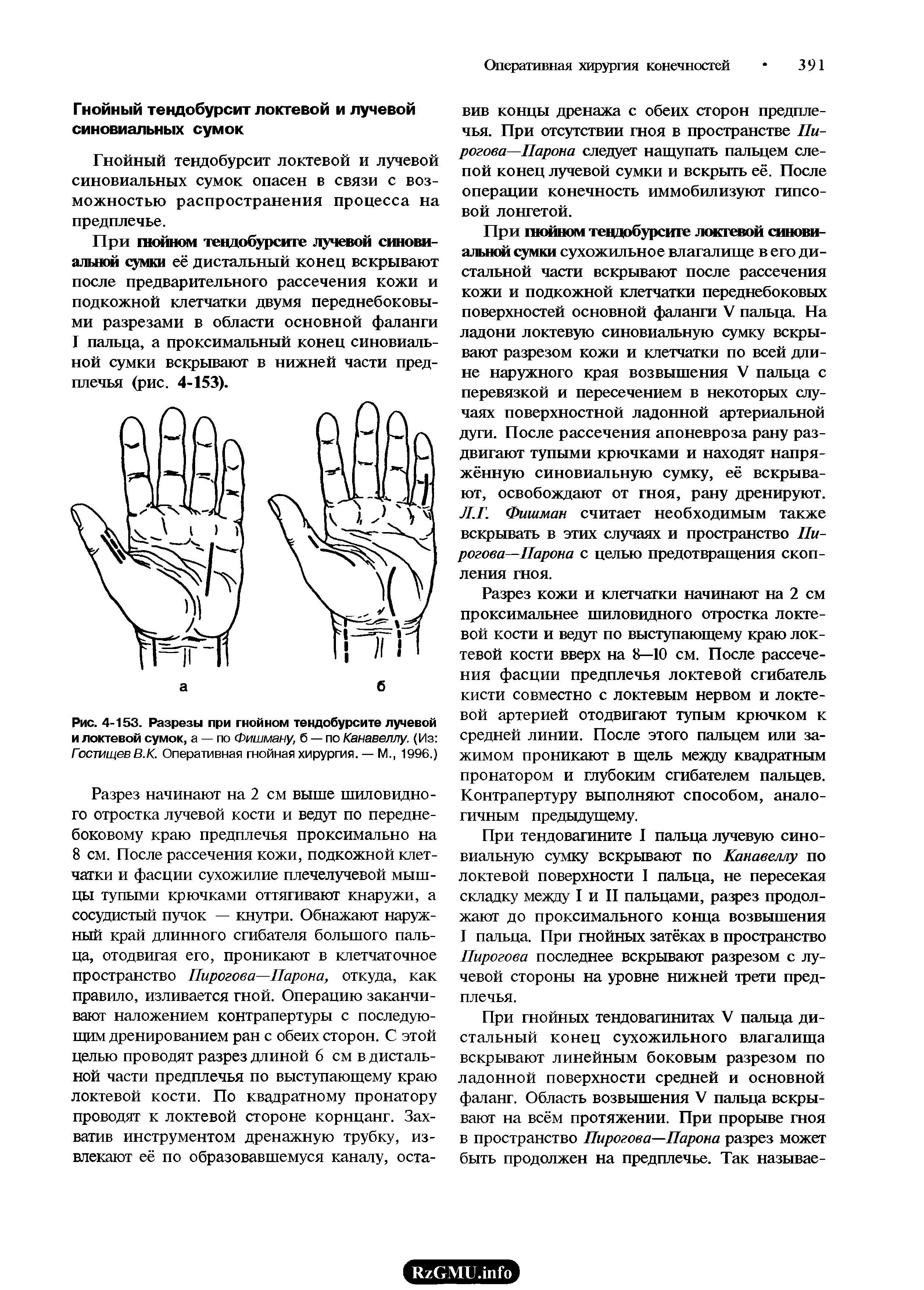 Рис. 4-153. Разрезы при гнойном тендобурсите лучевой и локтевой сумок, а — по Фишману, б — по Канавеллу. (Из Гостищев В.К. Оперативная гнойная хирургия. — М., 1996.)...