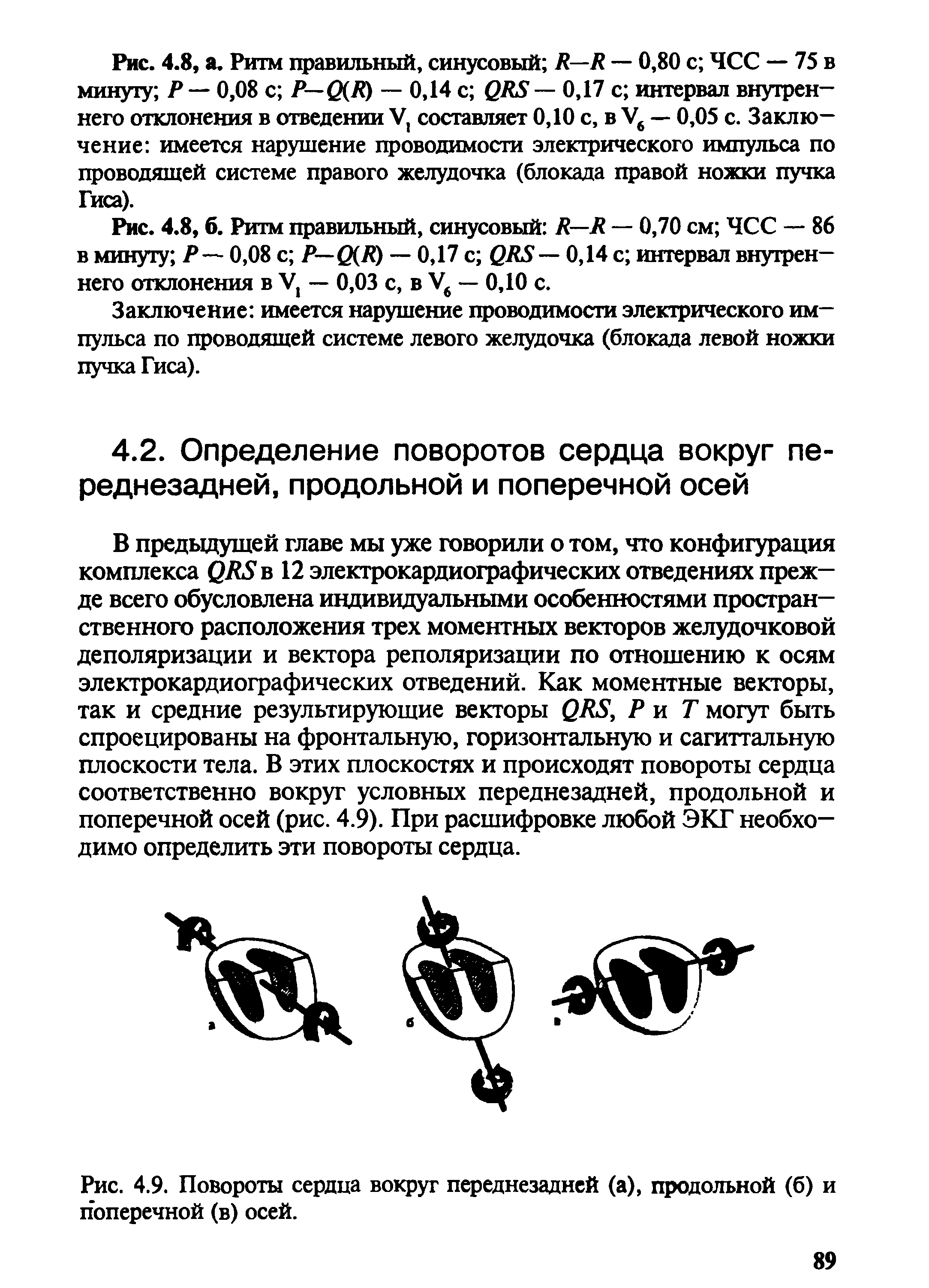 Рис. 4.9. Повороты сердца вокруг переднезадней (а), продольной (б) и поперечной (в) осей.