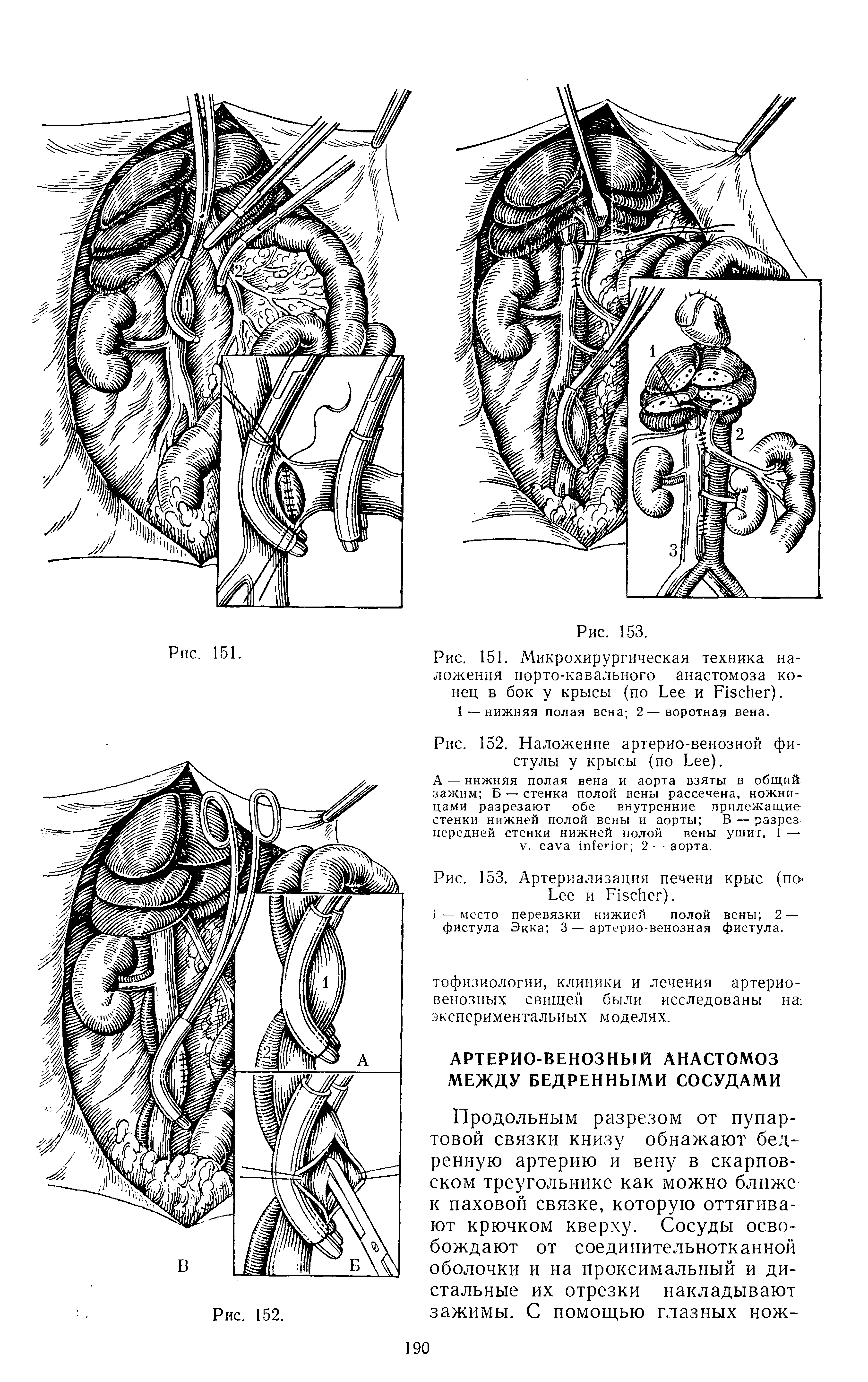 Рис. 151. Микрохирургическая техника наложения порто-кавального анастомоза конец в бок у крысы (по L и F ).