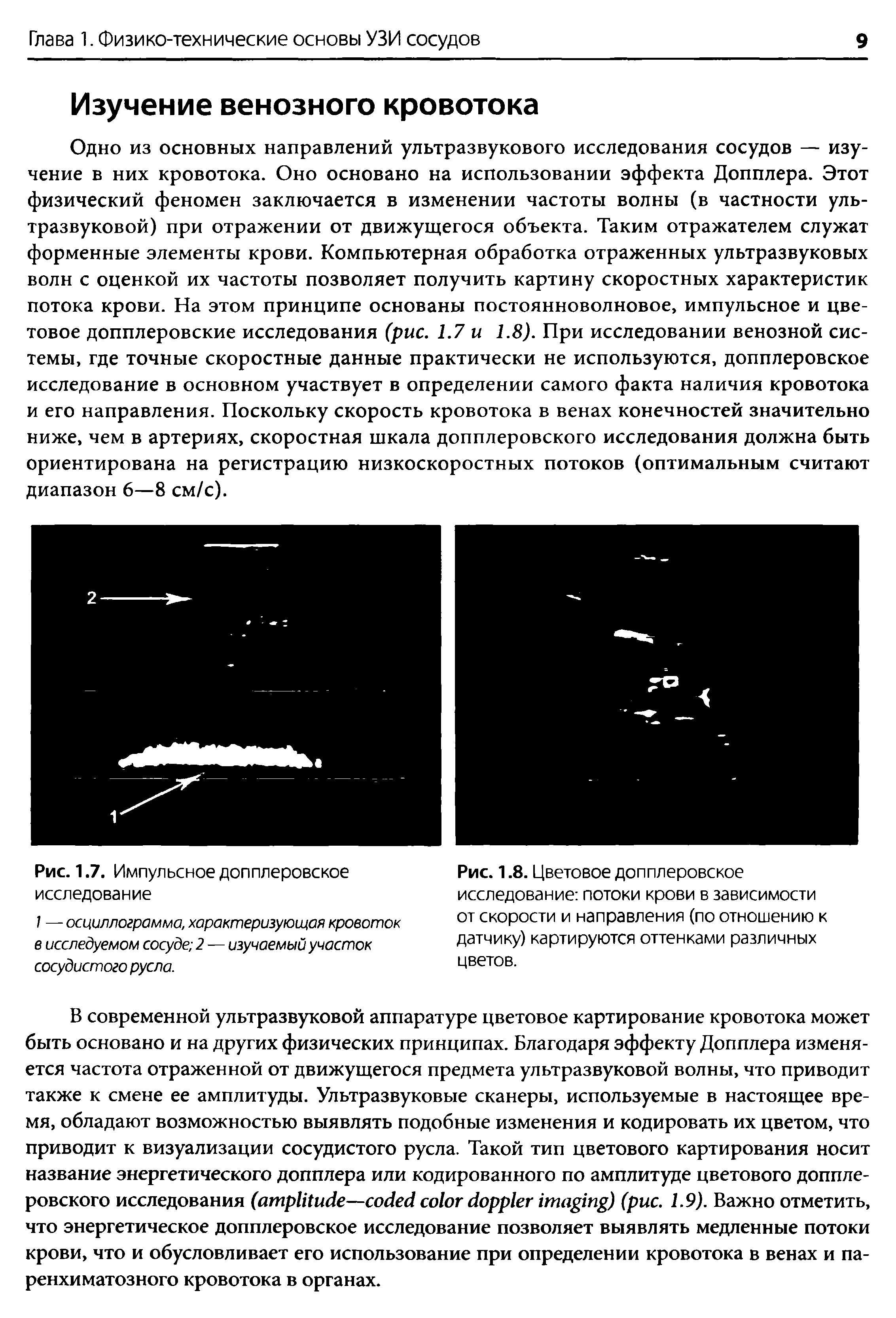 Рис. 1.8. Цветовое допплеровское исследование потоки крови в зависимости от скорости и направления (по отношению к датчику) картируются оттенками различных цветов.