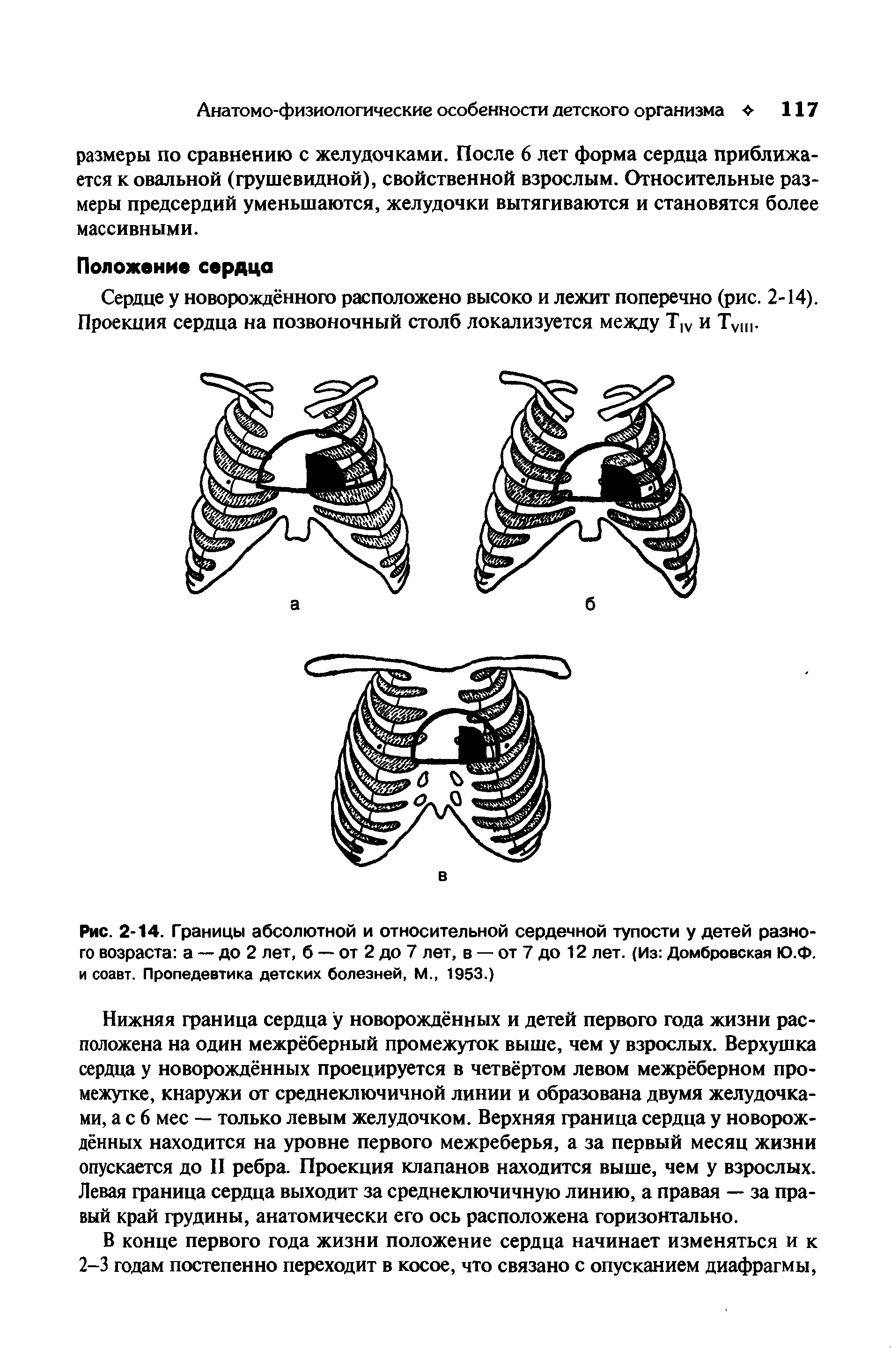 Рис. 2-14. Границы абсолютной и относительной сердечной тупости у детей разного возраста а — до 2 лет, б — от 2 до 7 лет, в — от 7 до 12 лет. (Из Домбровская Ю.Ф. и соавт. Пропедевтика детских болезней, М., 1953.)...