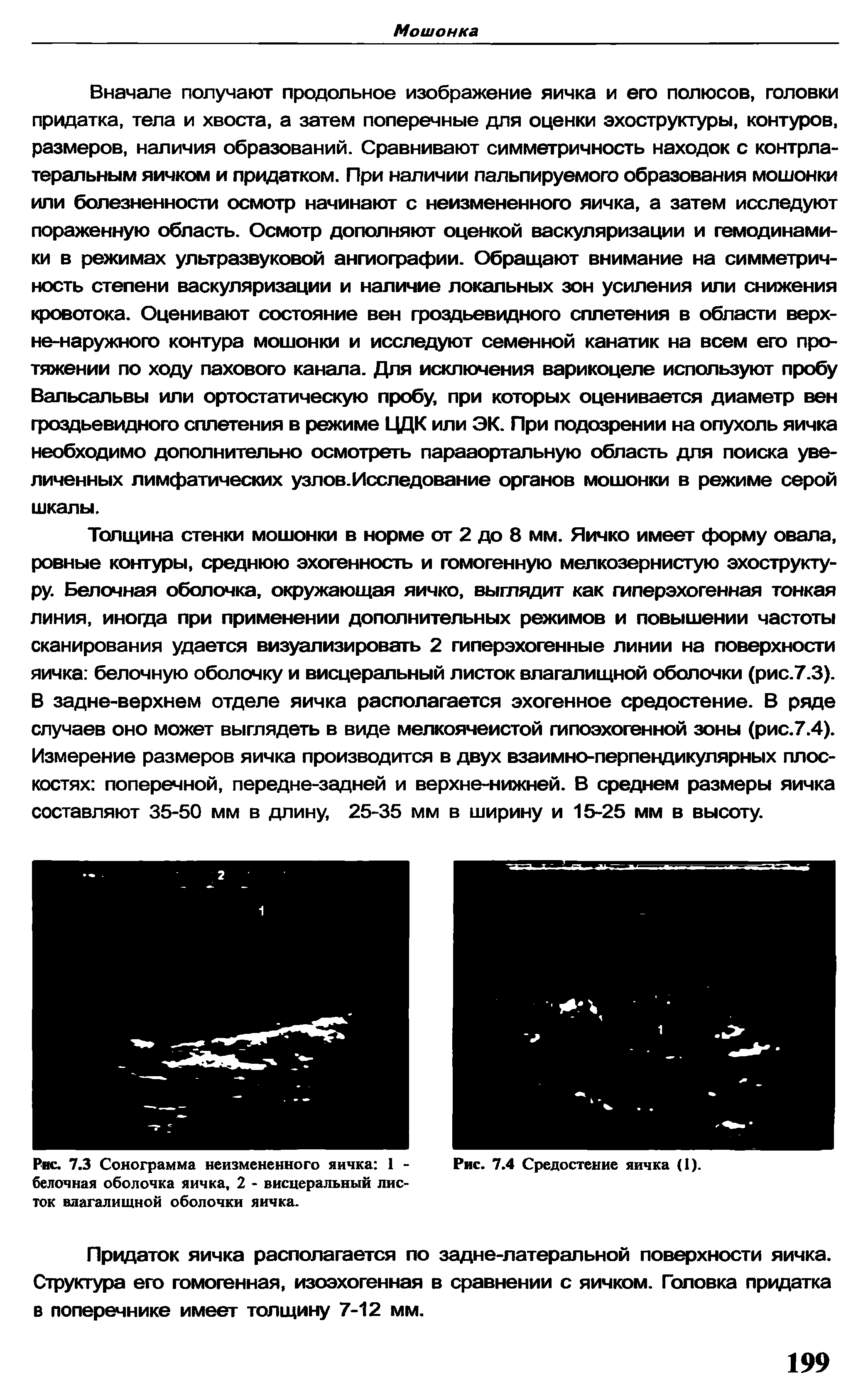 Рис. 7.3 Сонограмма неизмененного яичка 1 - Рис. 7.4 Средостение яичка (1). белочная оболочка яичка, 2 - висцеральный лис-...