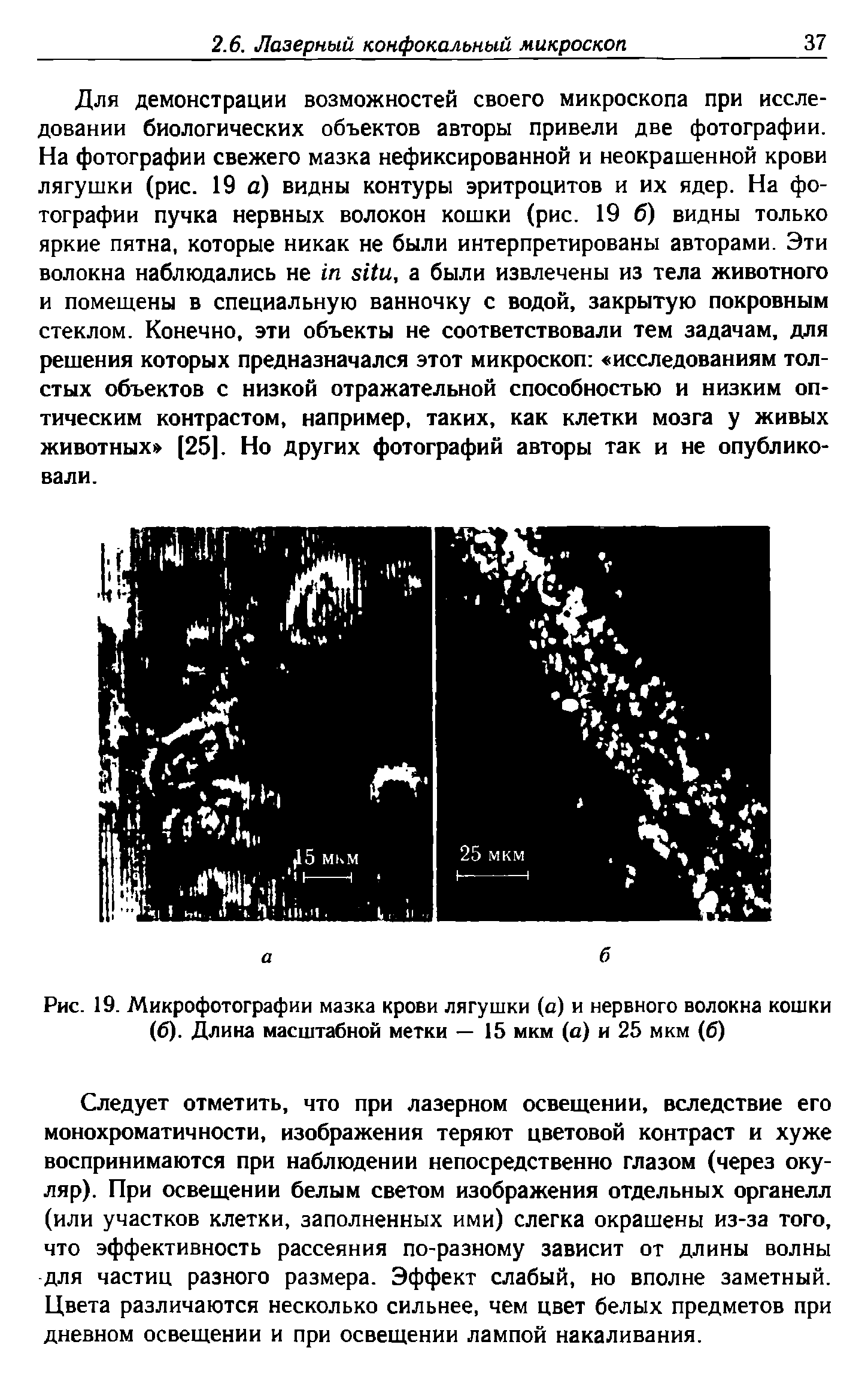 Рис. 19. Микрофотографии мазка крови лягушки (а) и нервного волокна кошки (б). Длина масштабной метки — 15 мкм (а) и 25 мкм (б)...