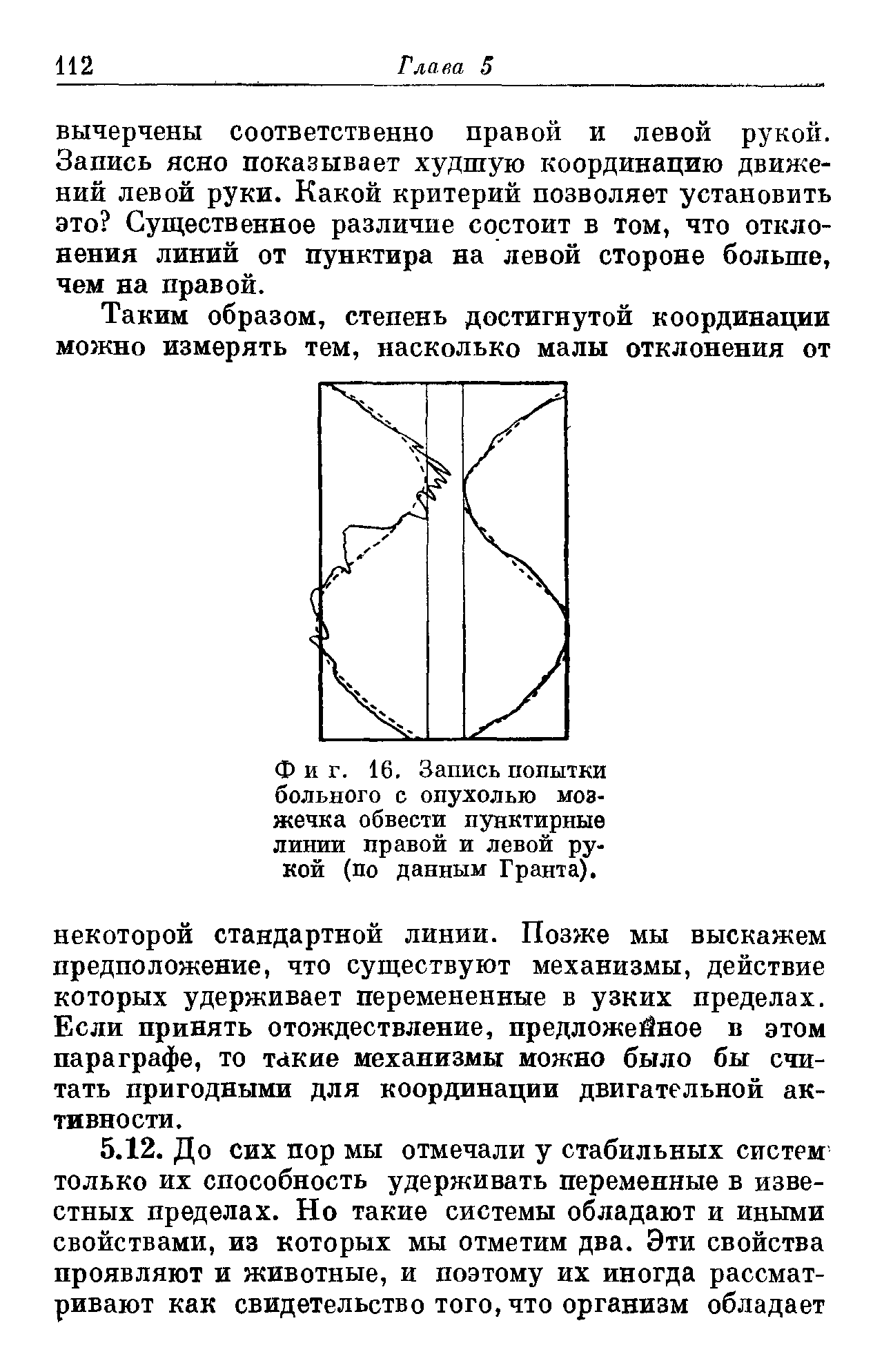 Фиг. 16. Запись попытки больного с опухолью мозжечка обвести пунктирные линии правой и левой рукой (по данным Гранта).