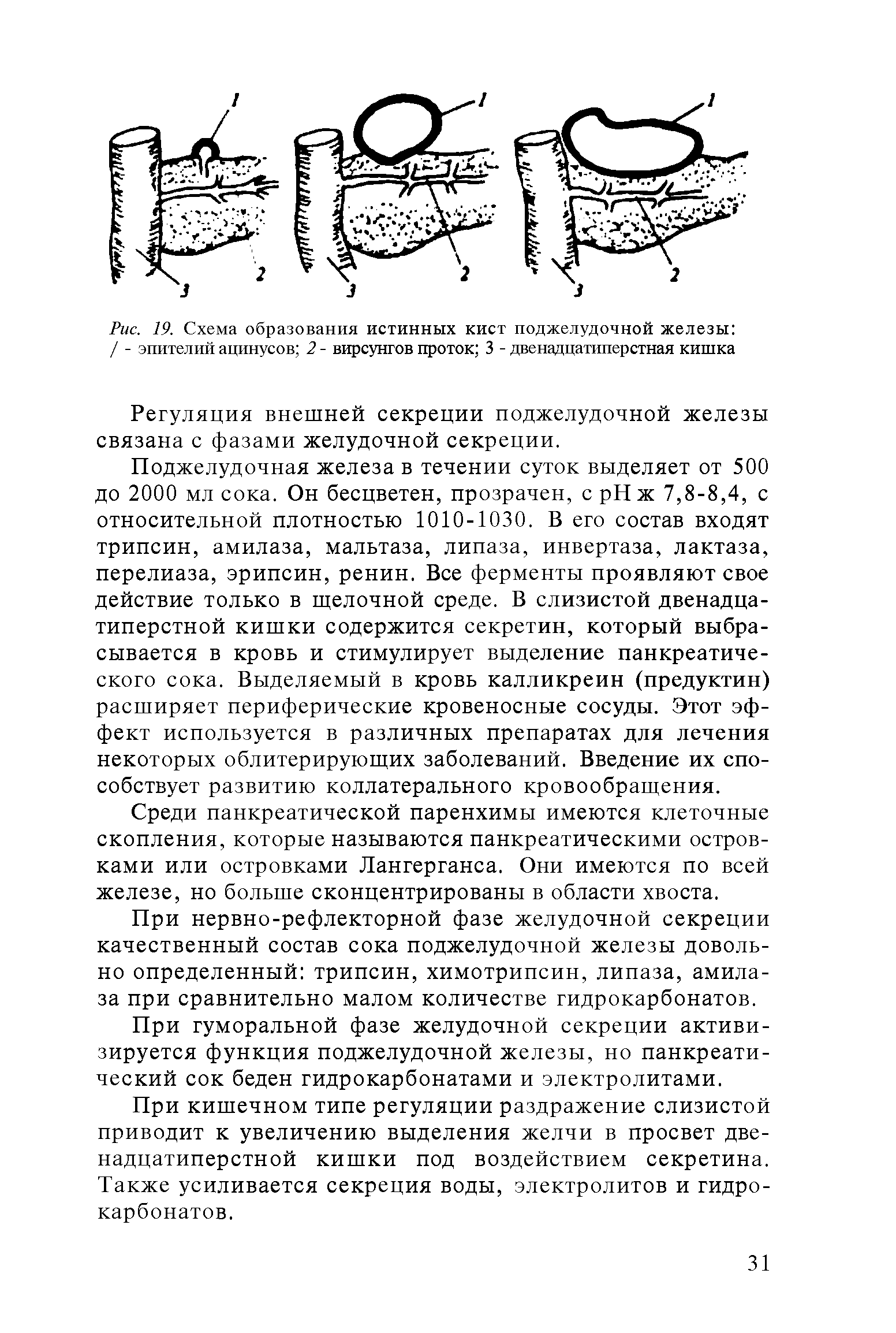 Рис. 19. Схема образования истинных кист поджелудочной железы / - эпителий ацинусов 2 - вирсунгов проток 3 - двенадцатиперстная кишка...