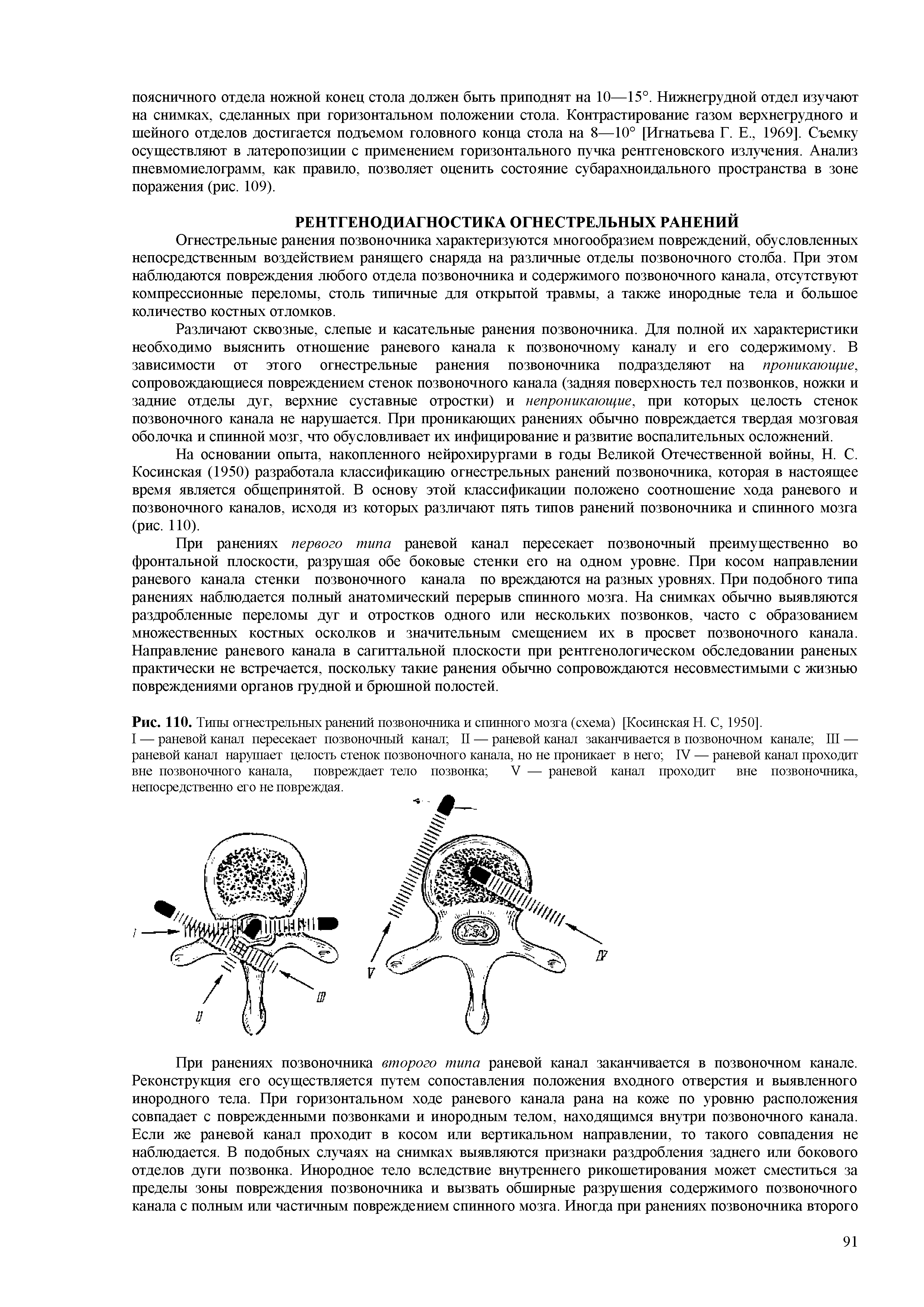 Рис. 110. Типы огнестрельных ранений позвоночника и спинного мозга (схема) [Косинская Н. С, 1950].