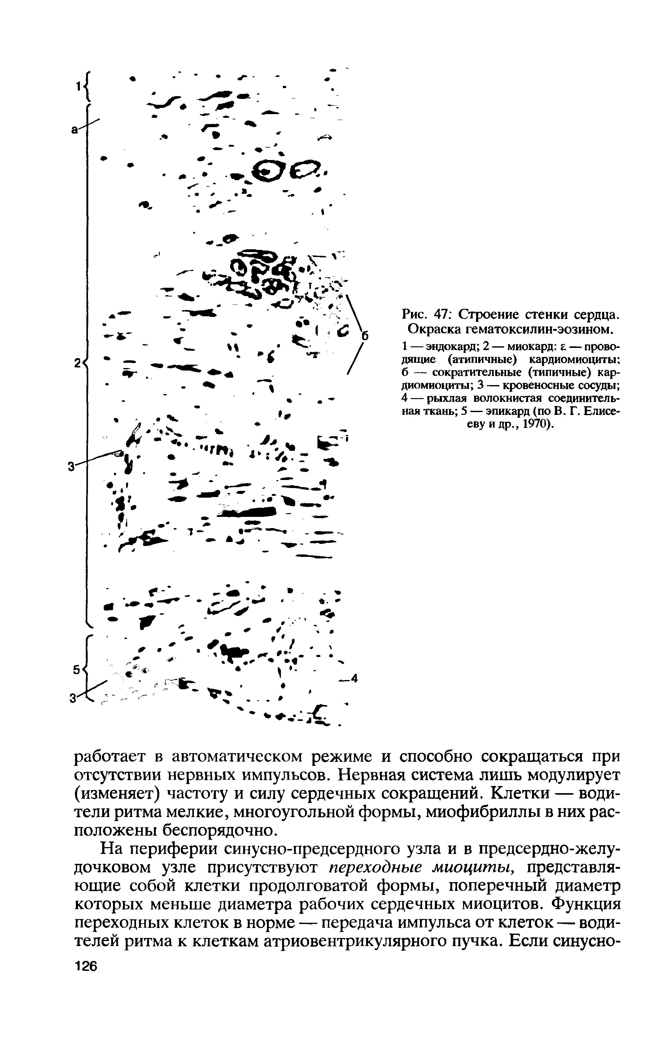 Рис. 47 Строение стенки сердца. Окраска гематоксилин-эозином.