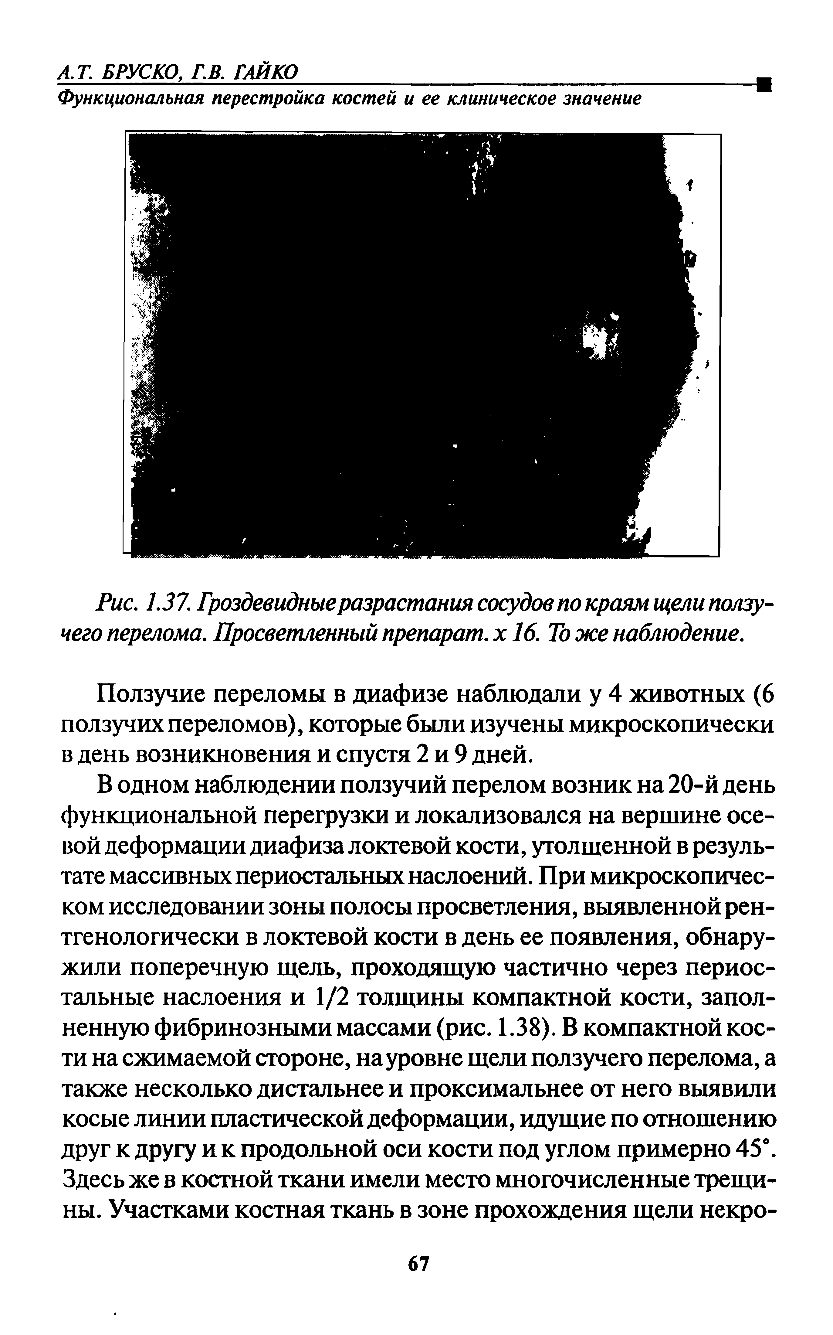 Рис. 1.37. Гроздевидные разрастания сосудов по краям щели ползучего перелома. Просветленный препарат, х 16. То же наблюдение.