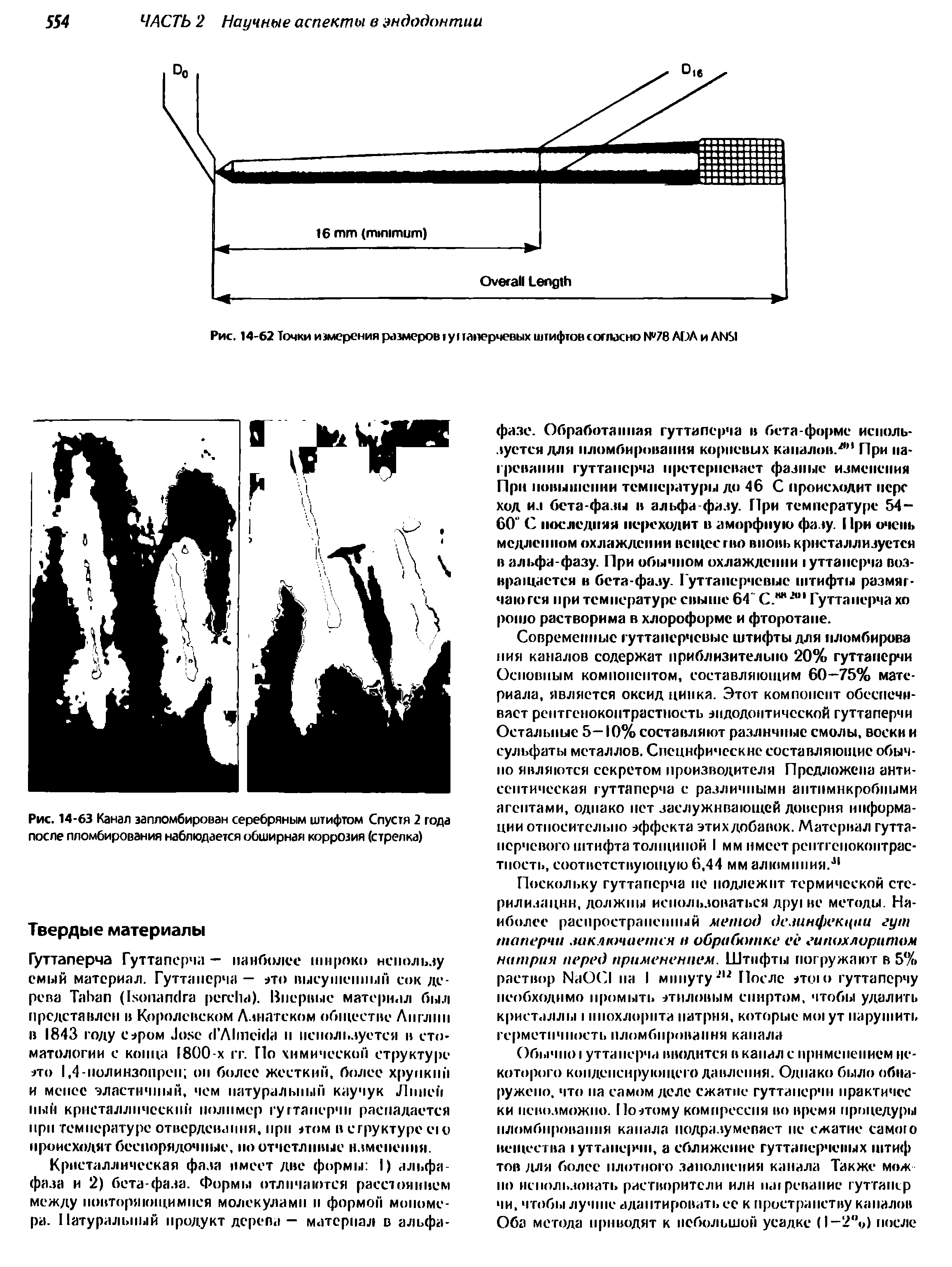 Рис. 14-63 Канал запломбирован серебряным штифтом Спустя 2 года после пломбирования наблюдается обширная коррозия (стрелка)...