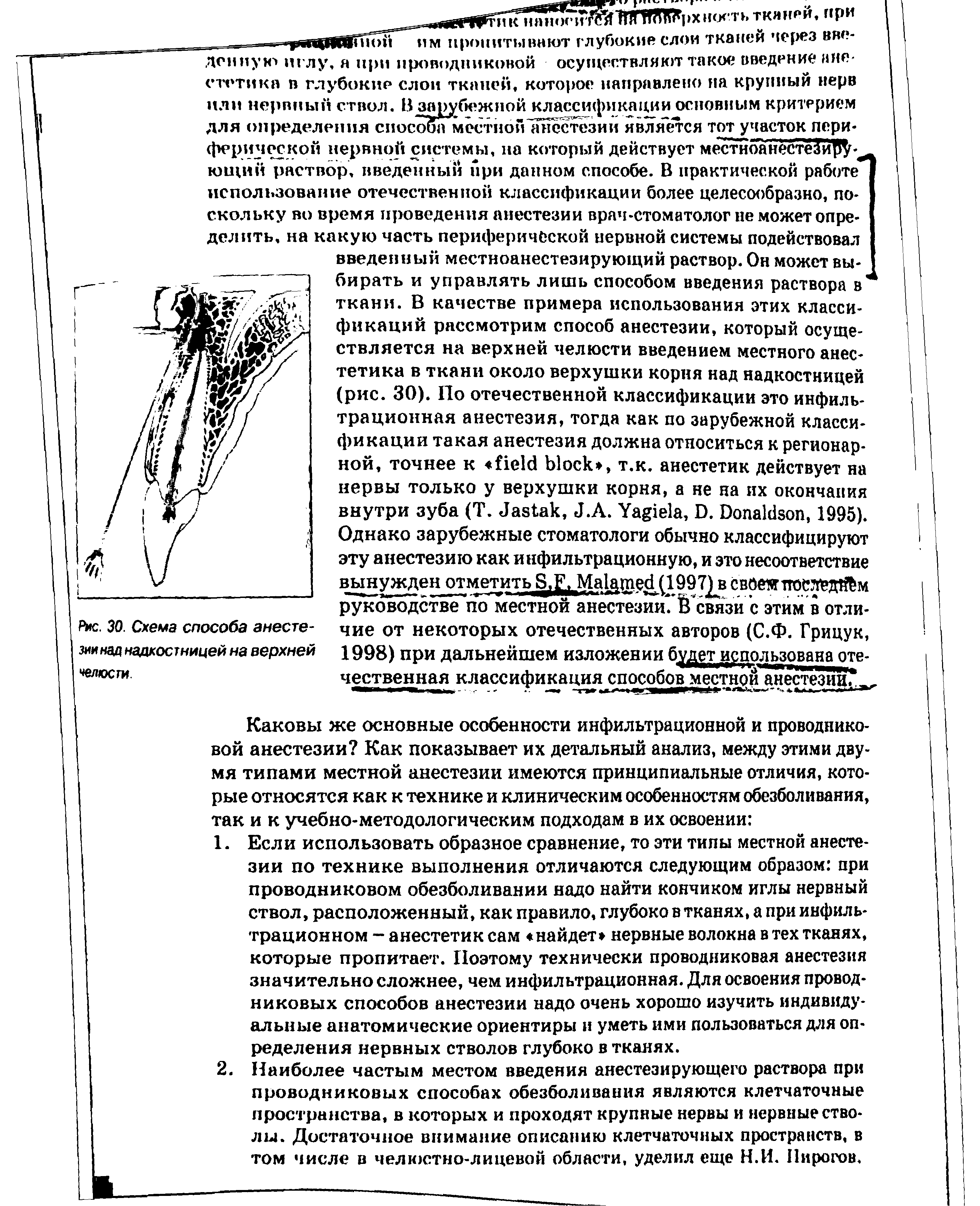 Рис. 30. Схема способа анестезии над надкостницей на верхней челюсги.