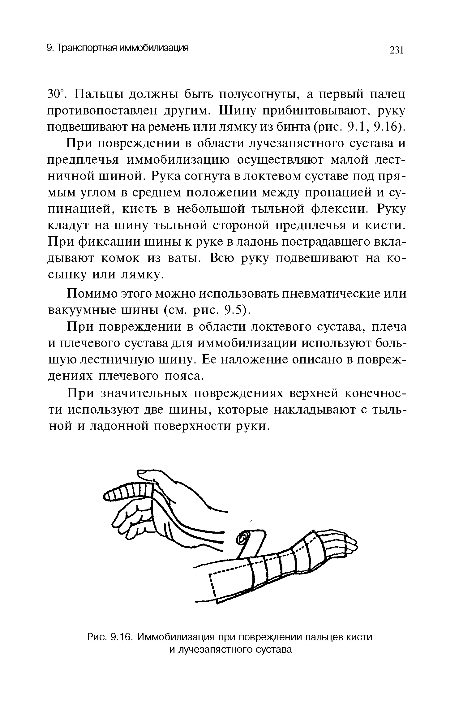 Рис. 9.16. Иммобилизация при повреждении пальцев кисти и лучезапястного сустава...