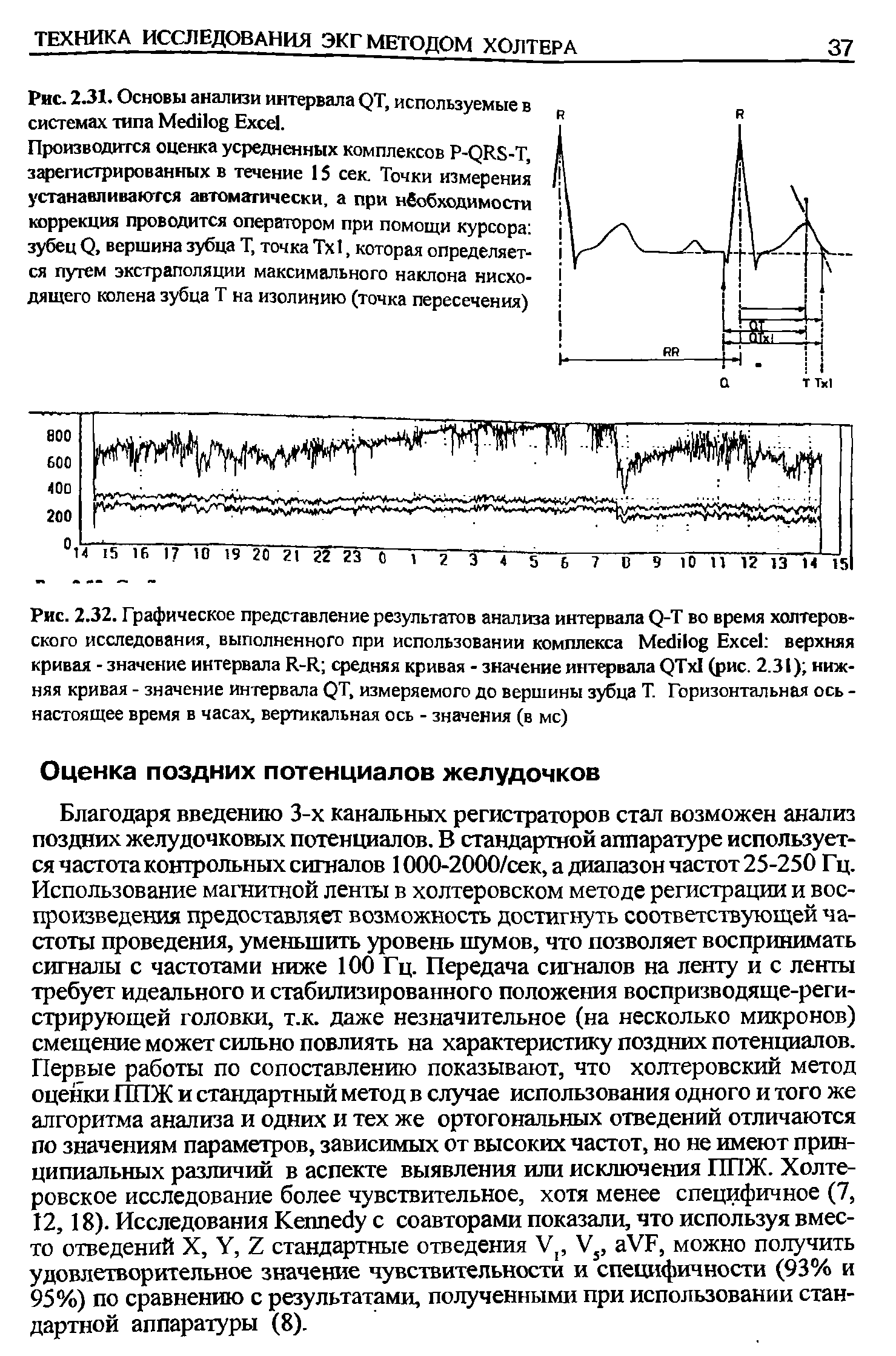 Рис. 2.31. Основы анализы интервала QT, используемые в системах типа M E .