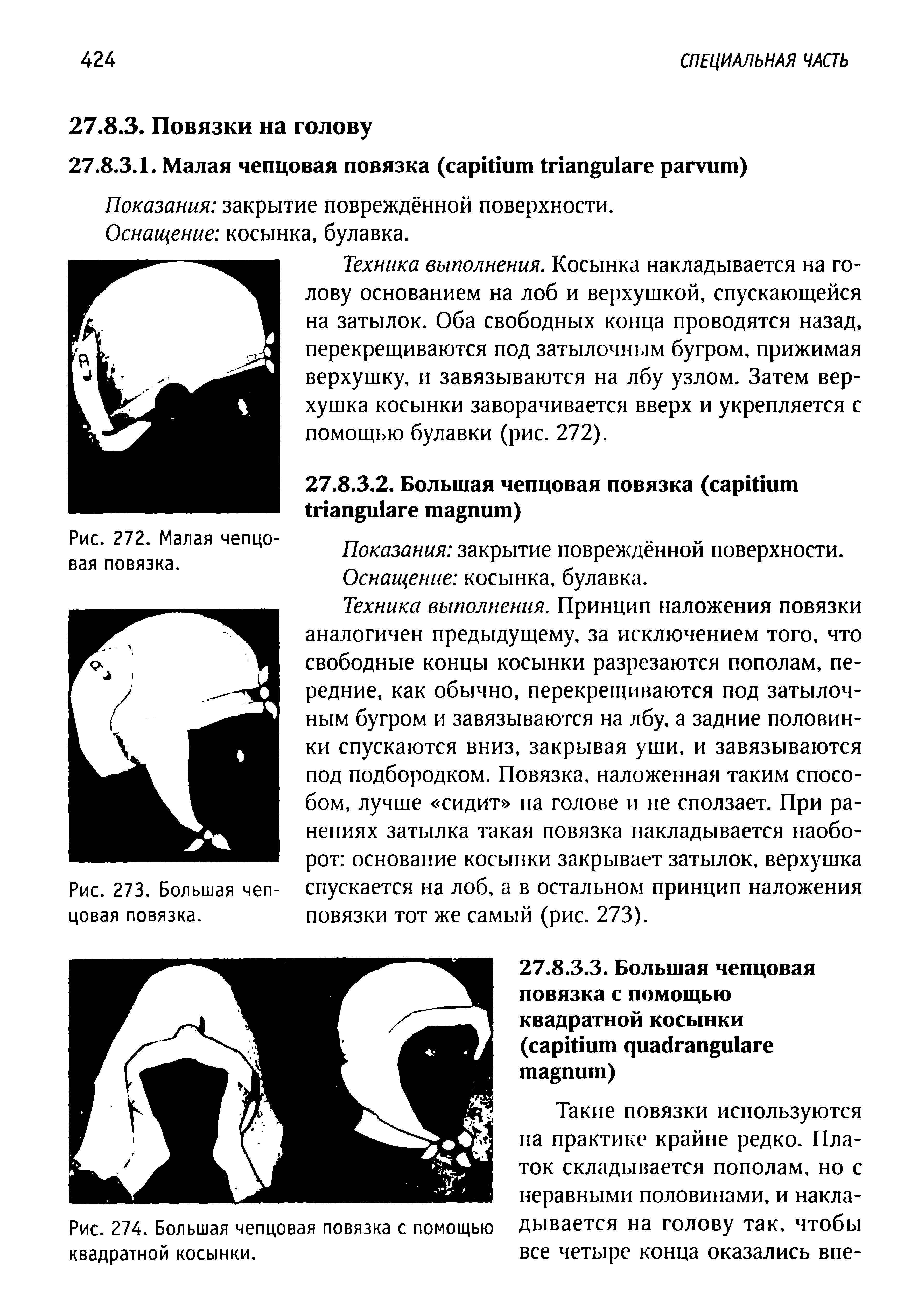 Рис. 274. Большая чепцовая повязка с помощью квадратной косынки.