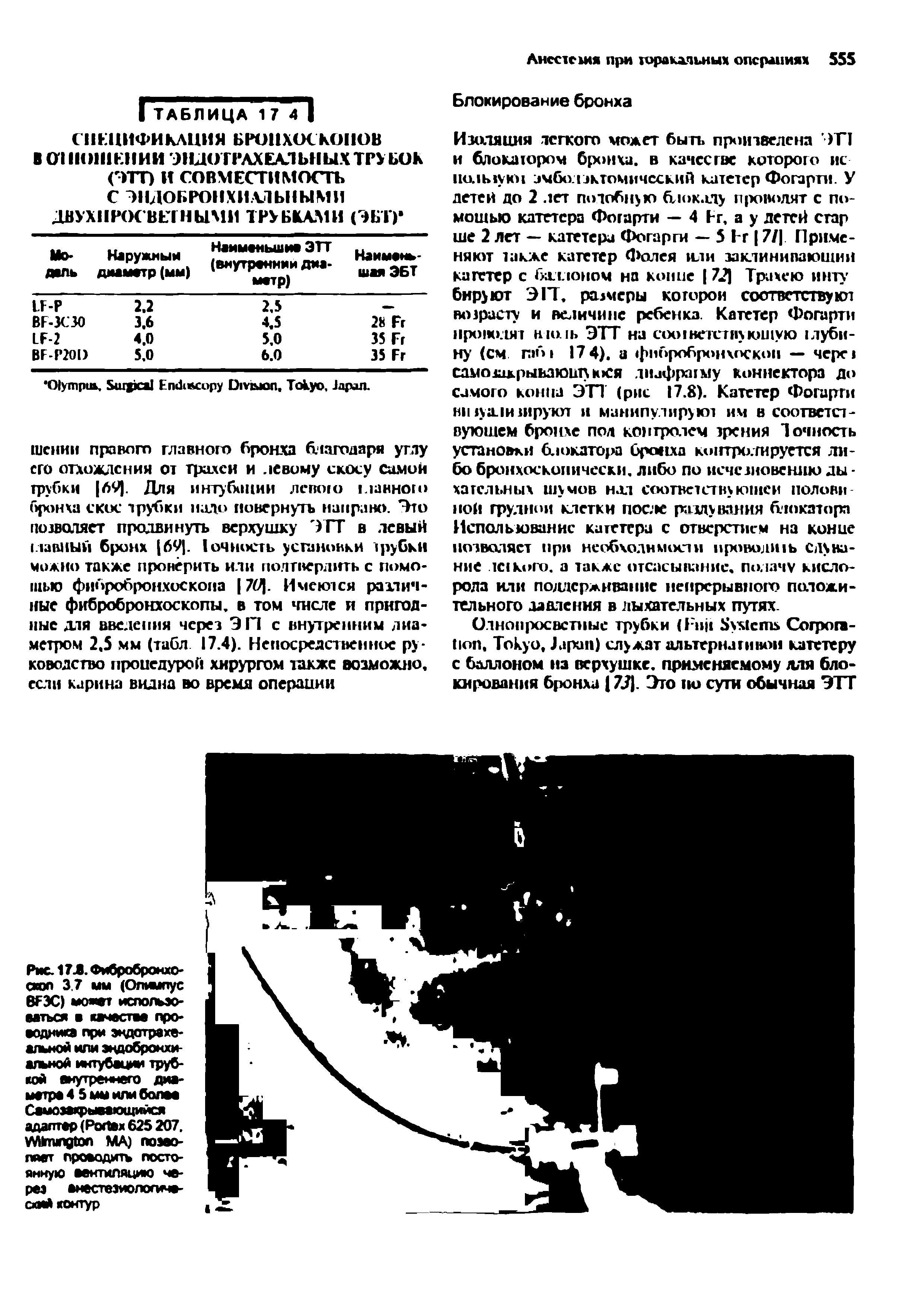 Рис. 17Л. Фибробронхо-сюп 3.7 мм (Олимпус 6F3C) может использоваться в качество проводника при эндотрахе-альной или эндобронхиальной интубации трубкой внутреннего диаметре 4 5 мы или болов Самозакрывающийся адаптер (P 625 207. W МА) позволяет проводить постоянную вентиляцию через анестезиологический контур...