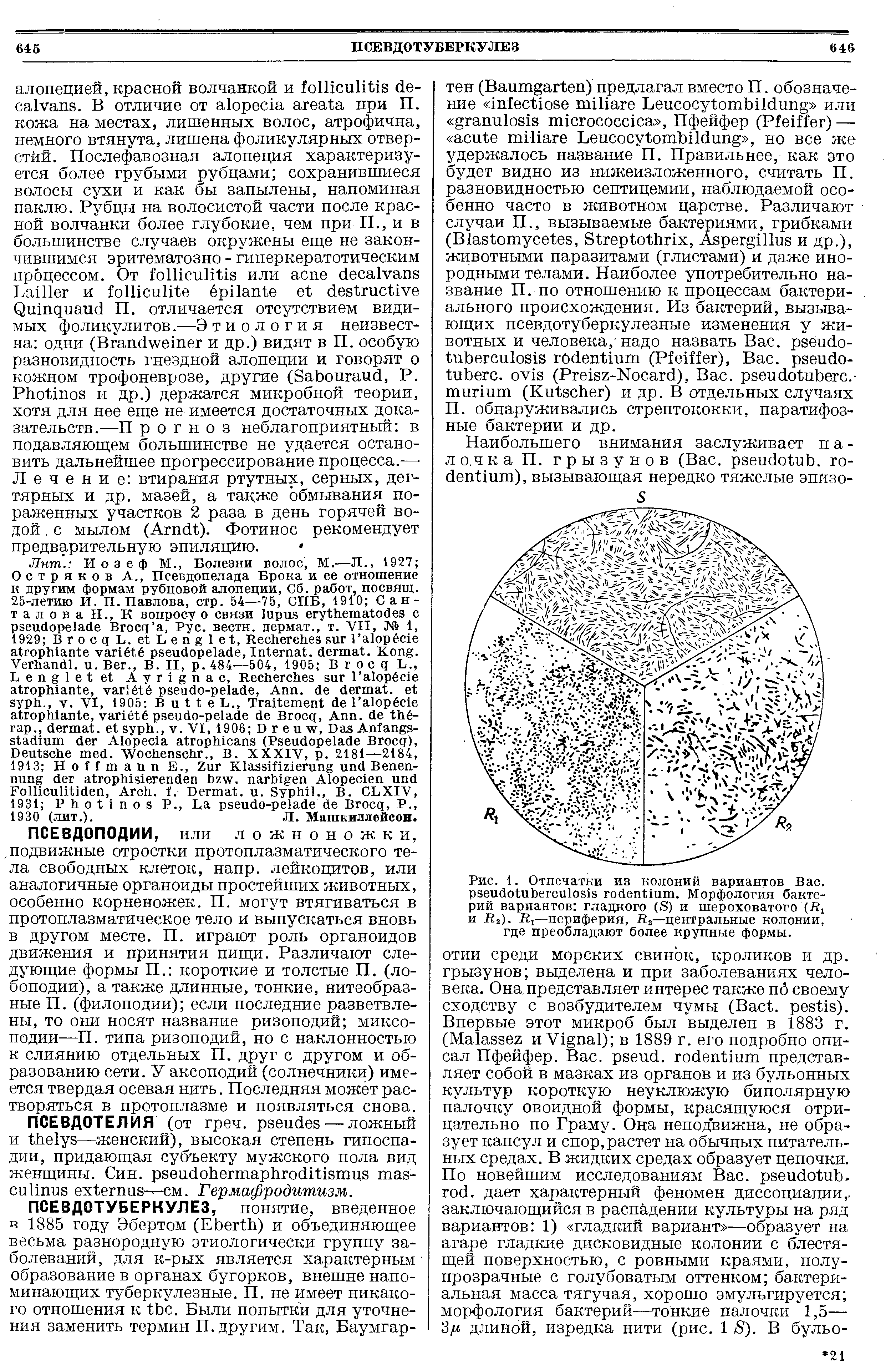 Рис. 1. Отпечатки из колоний вариантов Вас. . Морфология бактерий вариантов гладкого (S) и шероховатого (I и й2). R —периферия, Л2—центральные колонии, где преобладают более крупные формы.