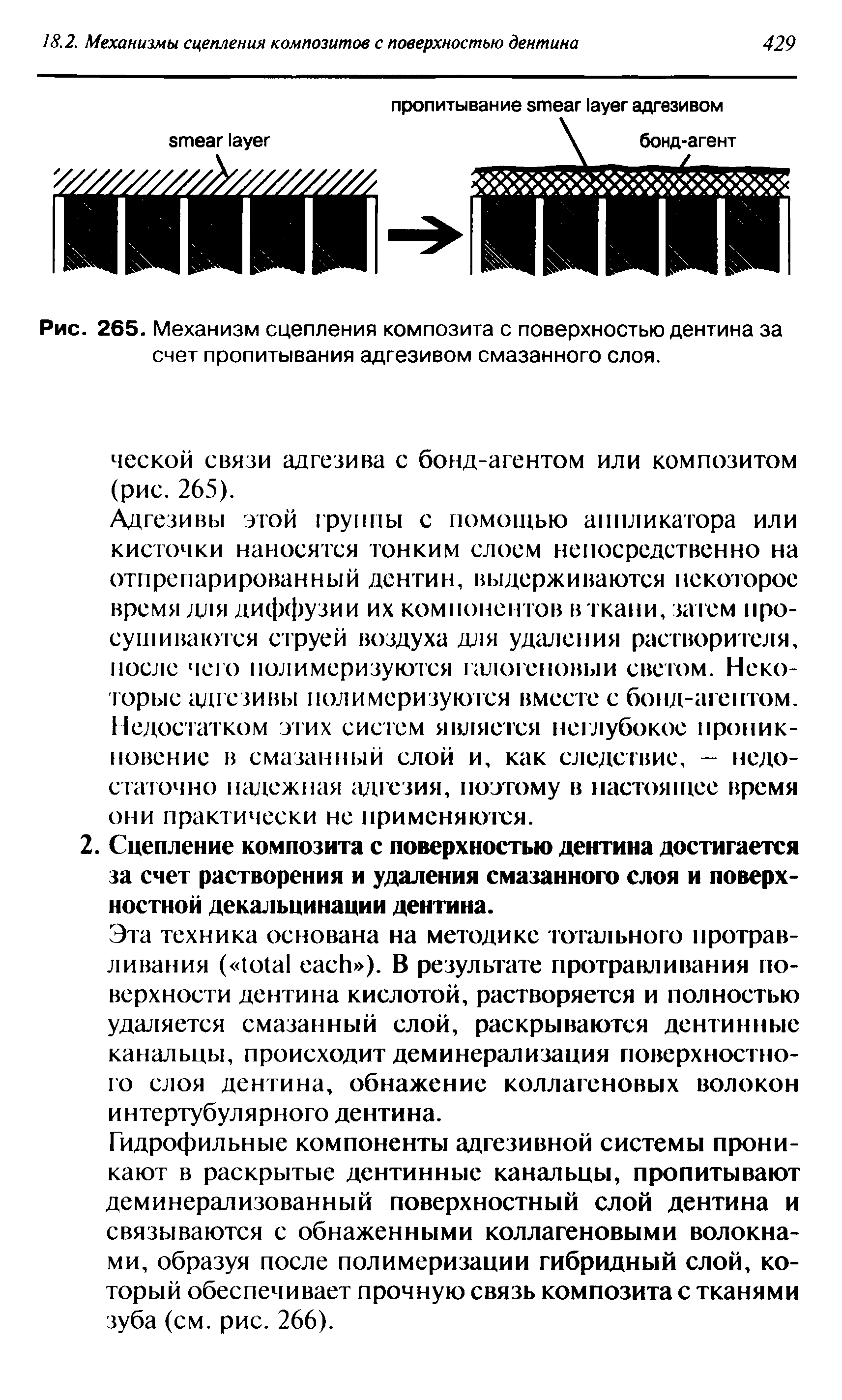 Рис. 265. Механизм сцепления композита с поверхностью дентина за счет пропитывания адгезивом смазанного слоя.