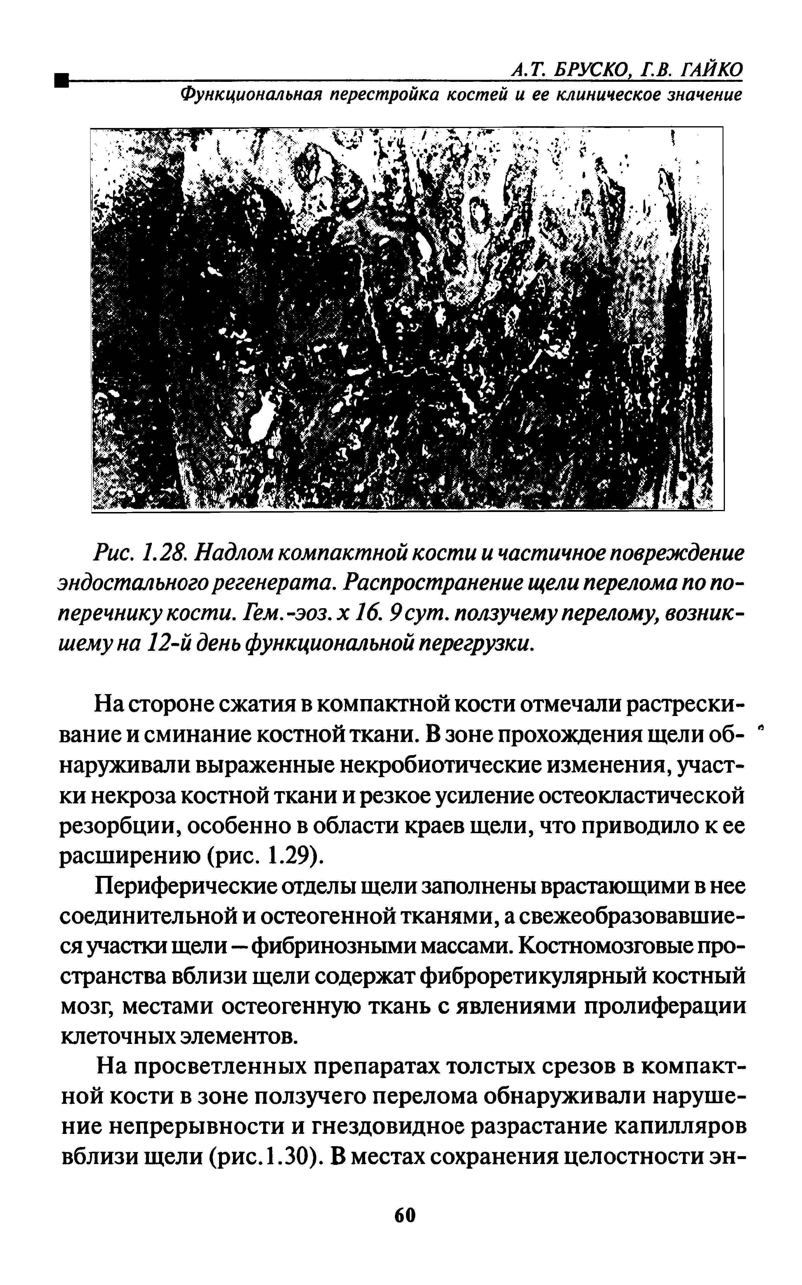 Рис. 1.28. Надлом компактной кости и частичное повреждение эндостального регенерата. Распространение щели перелома по поперечнику кости. Гем.-эоз. х 16. 9 сут. ползучему перелому, возникшему на 12-й день функциональной перегрузки.