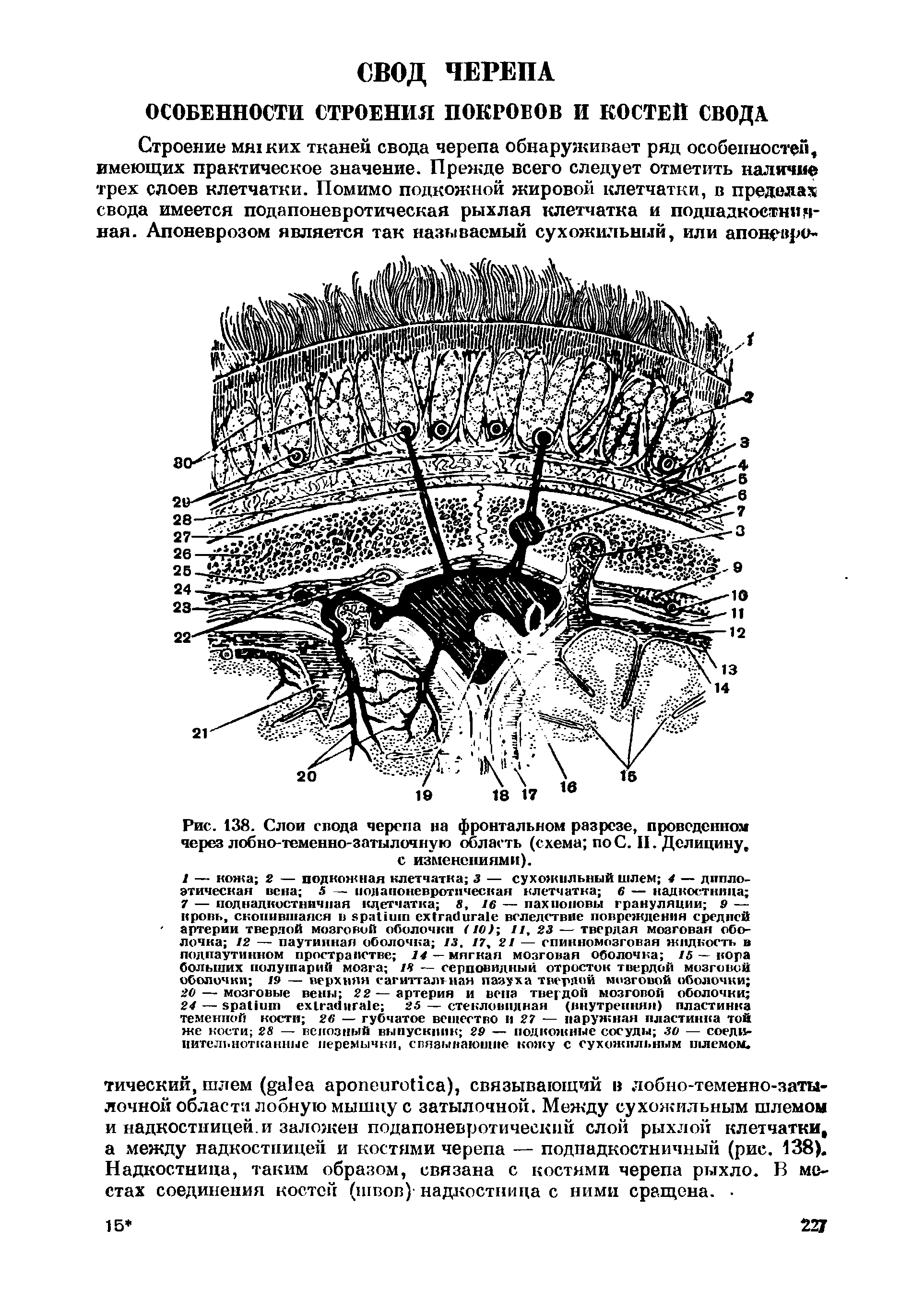 Рис. 138. Слои свода черепа на фронтальном разрезе, проведенном через лобно-теменно-затылочную область (схема по С. II. Делицину, с изменениями).