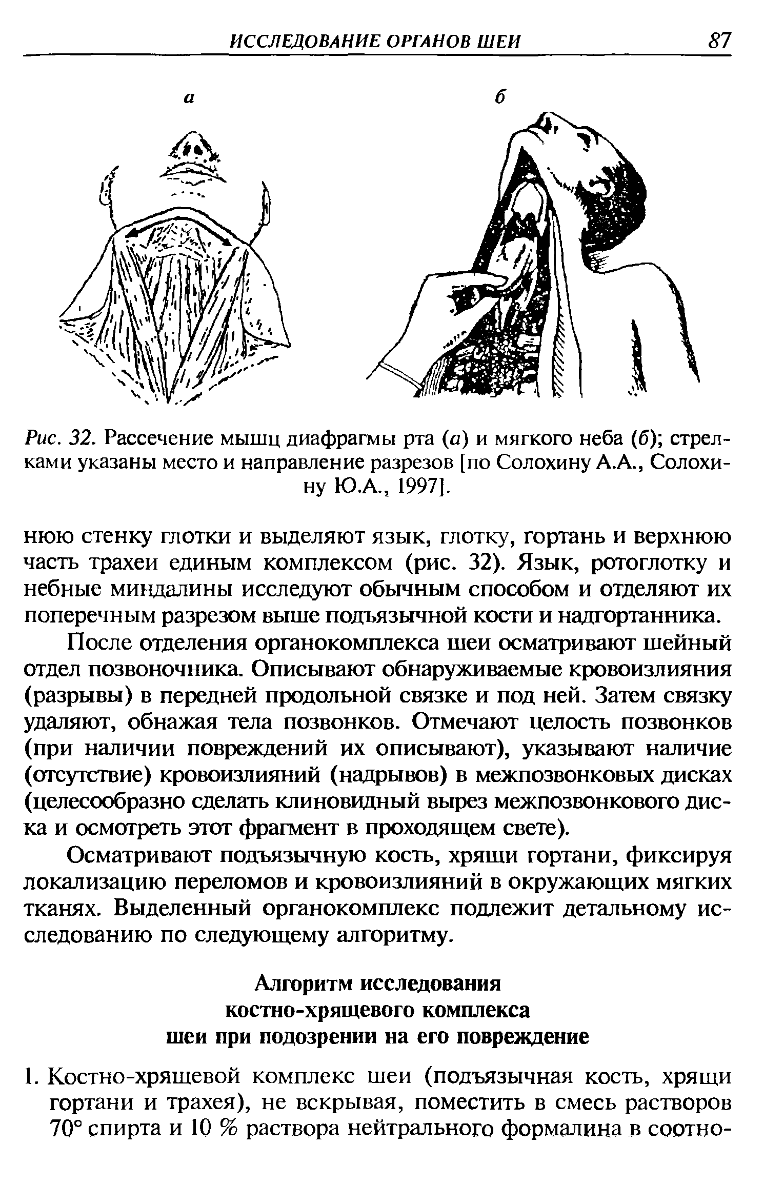 Рис. 32. Рассечение мышц диафрагмы рта (а) и мягкого неба (б) стрелками указаны место и направление разрезов [по Солохину А.А., Солохину Ю.А., 1997].