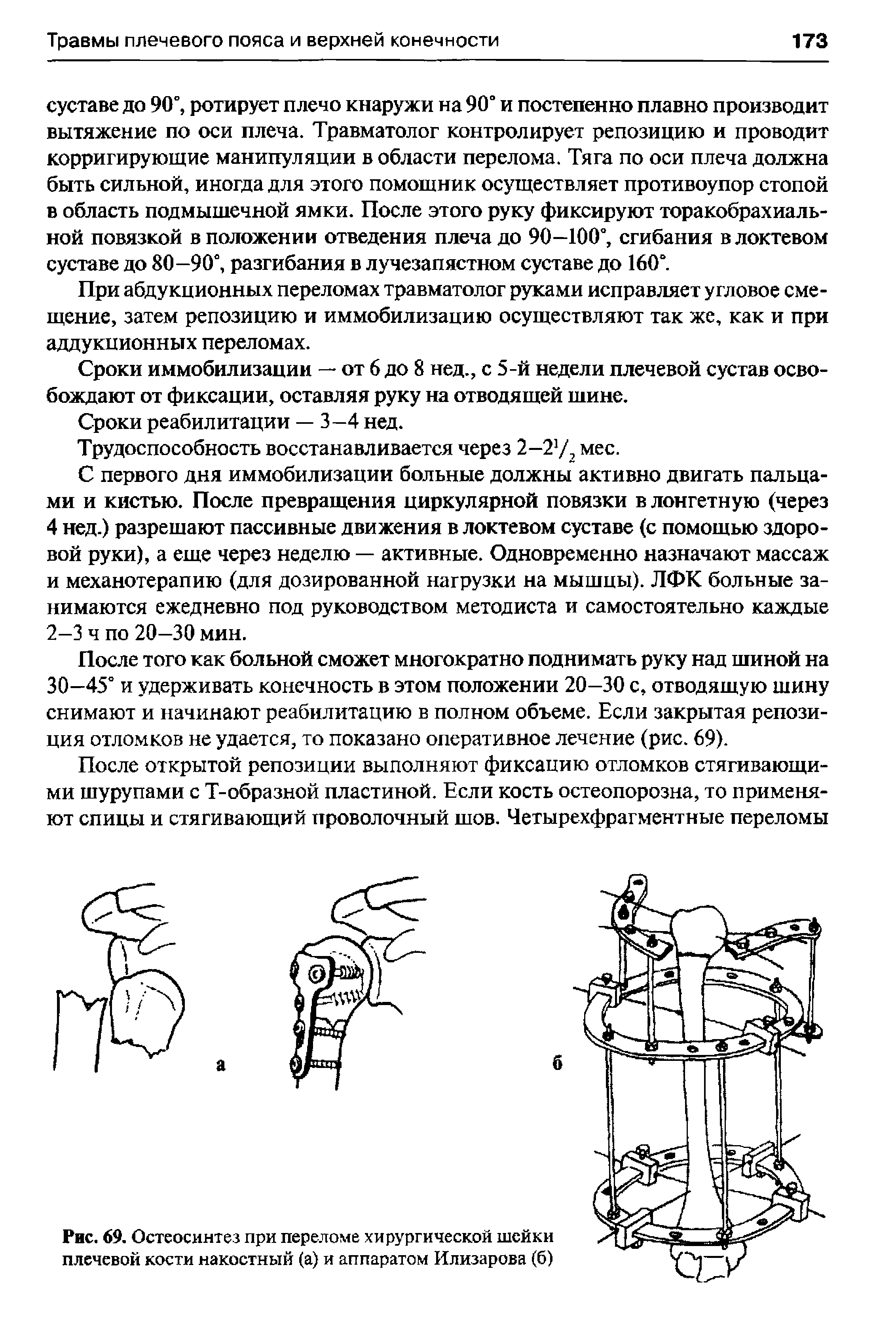 Рис. 69. Остеосинтез при переломе хирургической шейки плечевой кости накостный (а) и аппаратом Илизарова (б)...