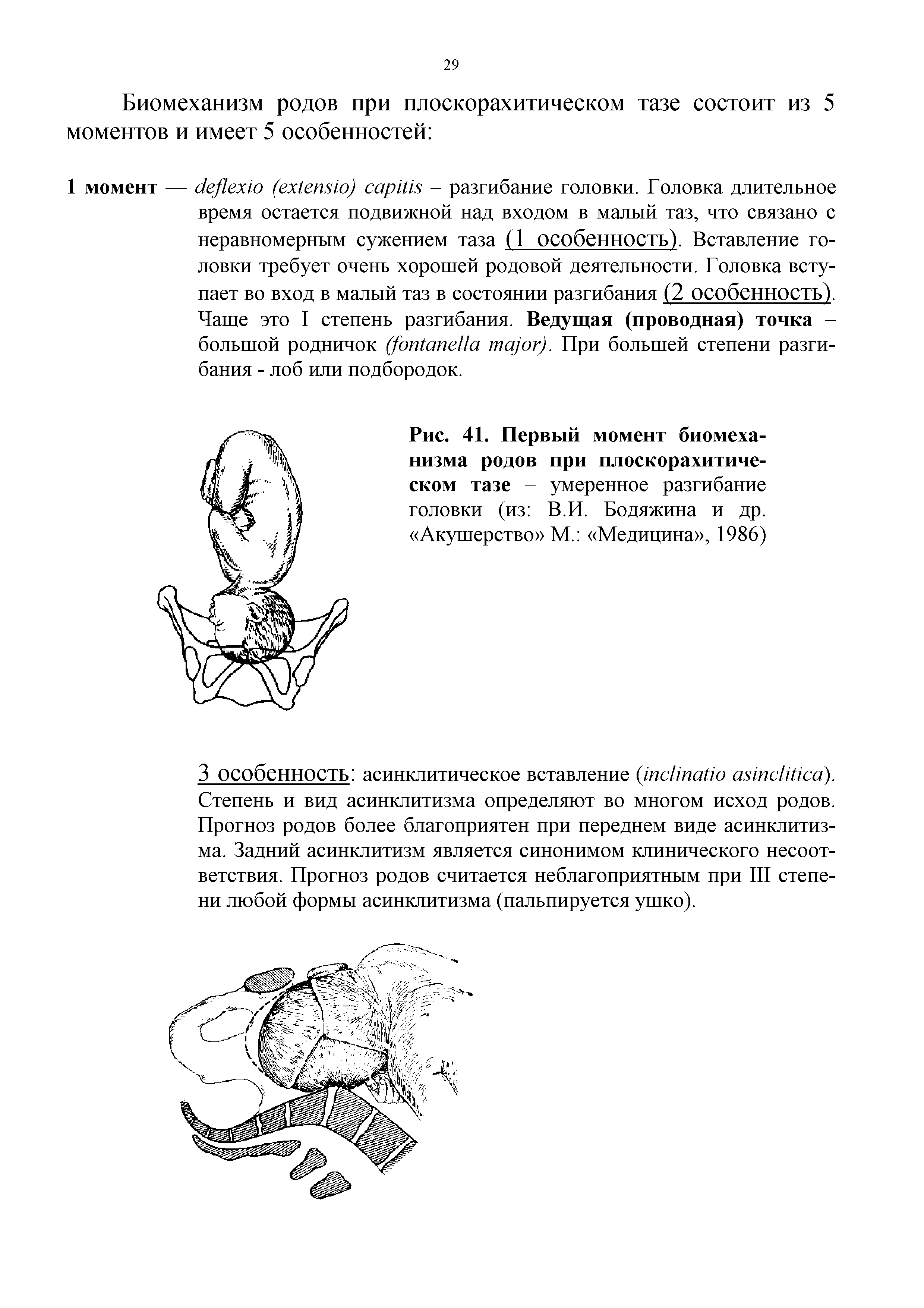 Рис. 41. Первый момент биомеханизма родов при плоскорахитическом тазе - умеренное разгибание головки (из В.И. Бодяжина и др. Акушерство М. Медицина , 1986)...