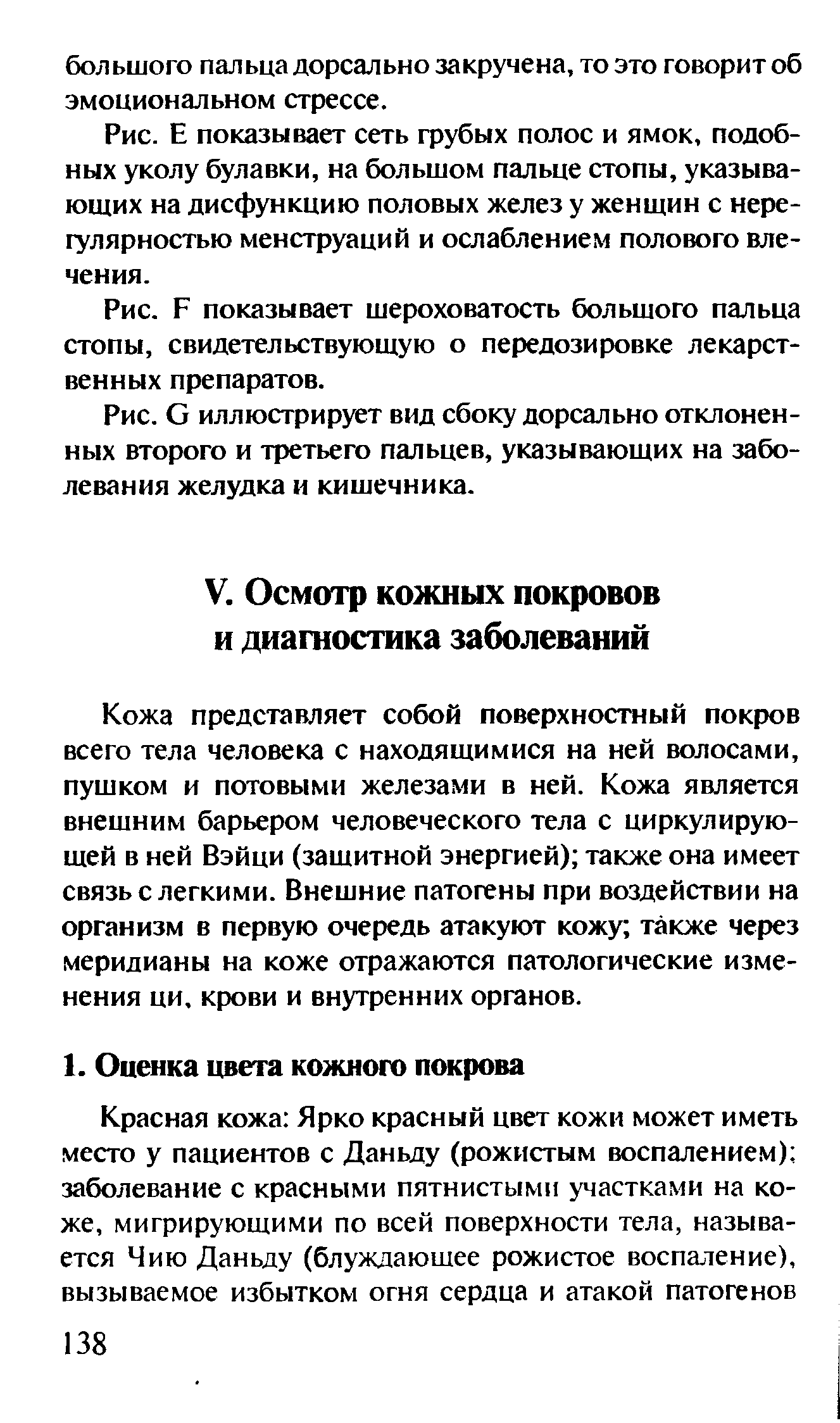 Рис. Б показывает шероховатость большого пальца стопы, свидетельствующую о передозировке лекарственных препаратов.