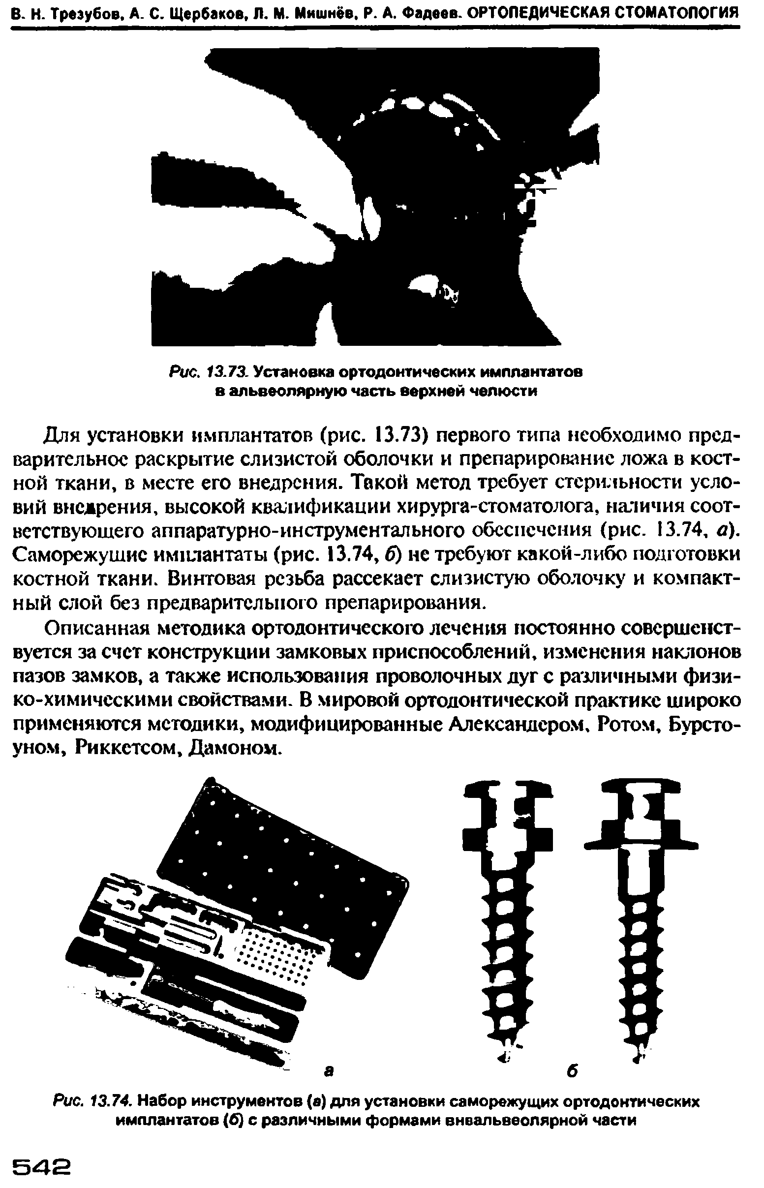 Рис. 13.74. Набор инструментов (а) для установки саморежущих ортодонтических имплантатов (6) с различными формами внвальвеолярной части...