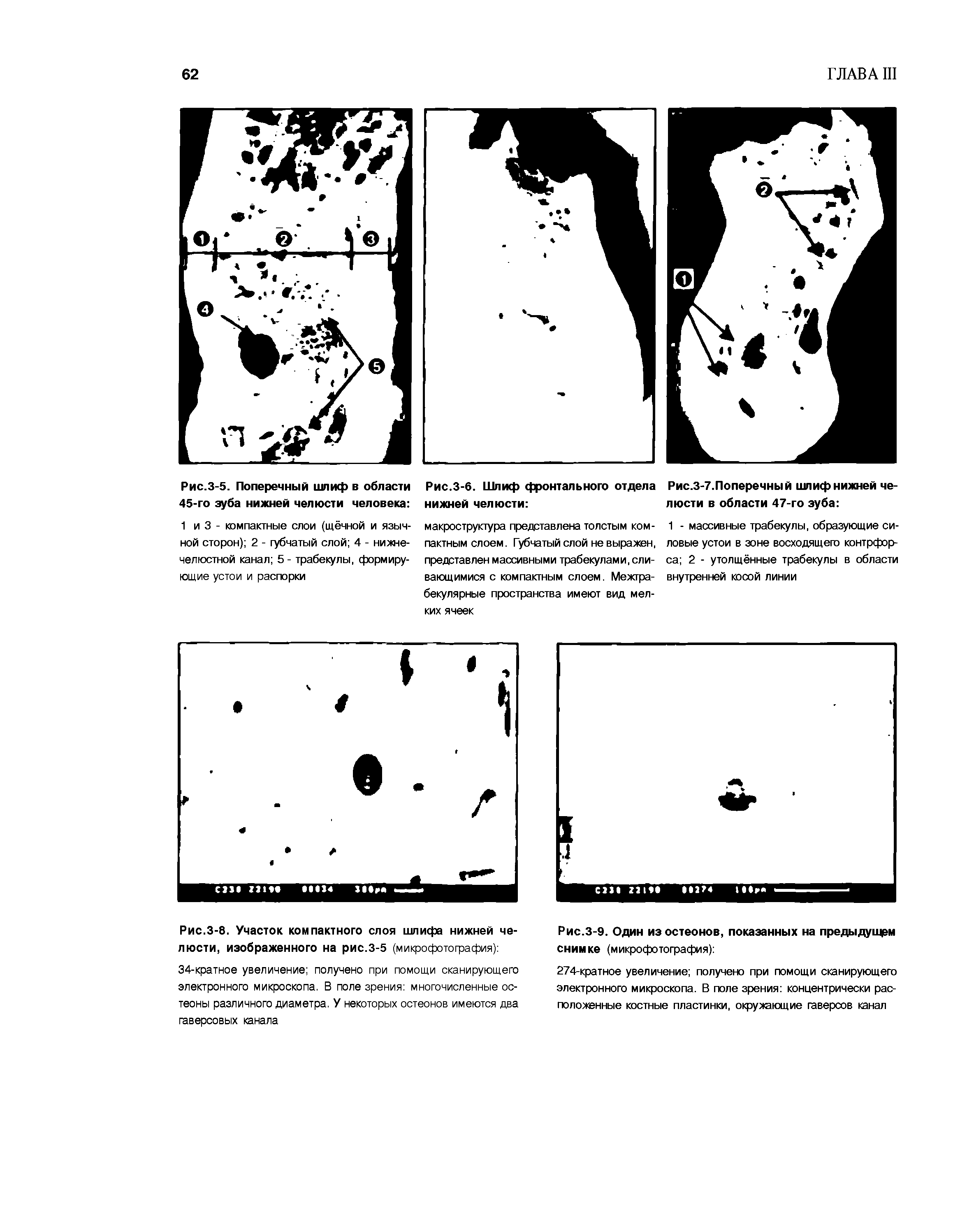 Рис.3-8. Участок компактного слоя шлифа нижней челюсти, изображенного на рис.3-5 (микрофотография) ...