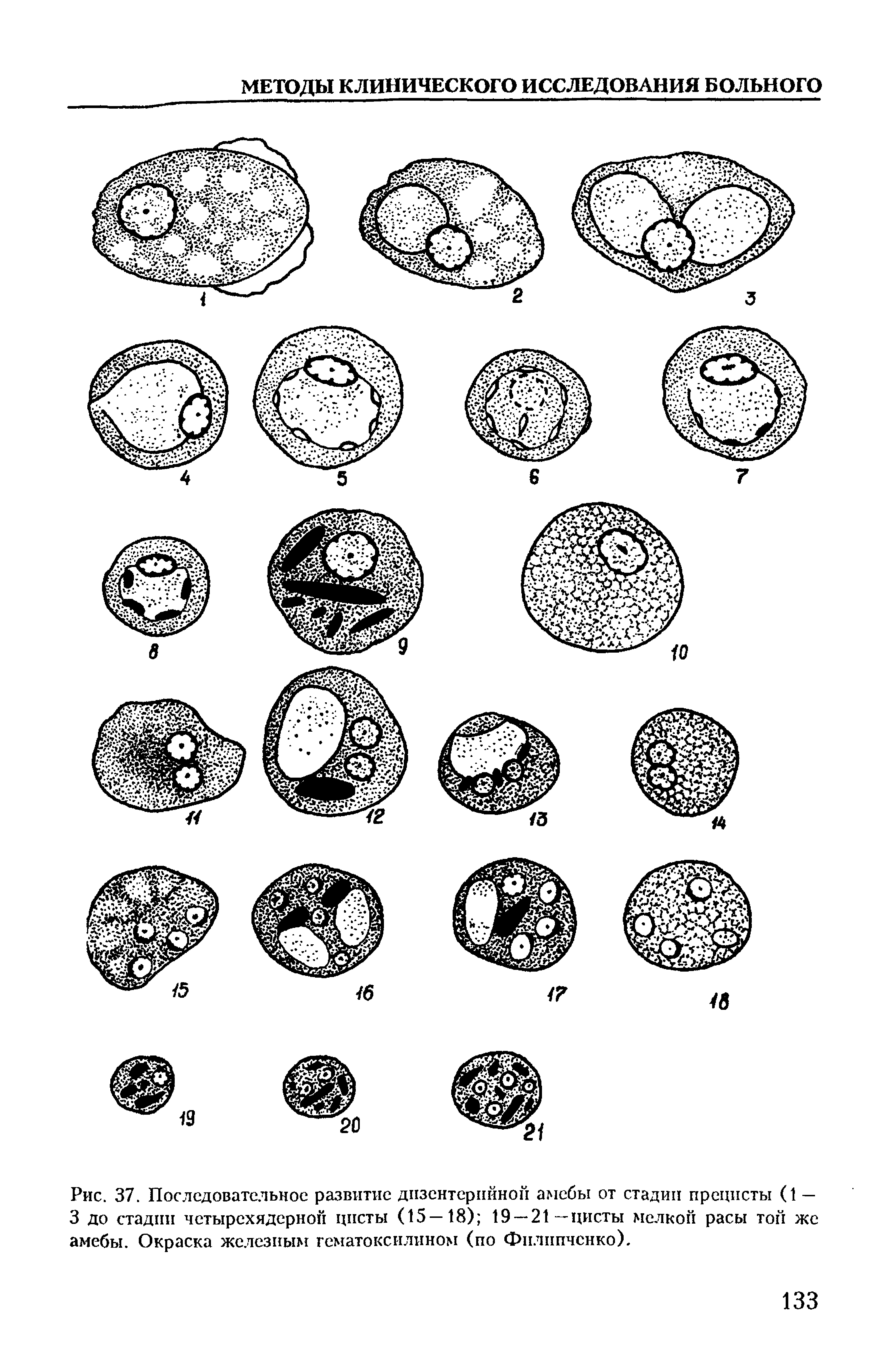 Рис. 37. Последовательное развитие дизентерийной амебы от стадии прецисты (1 — 3 до стадии четырехядерноп цисты (15—18) 19 —21—цисты мелкой расы той же амебы. Окраска железным гематоксилином (по Филиппенко).