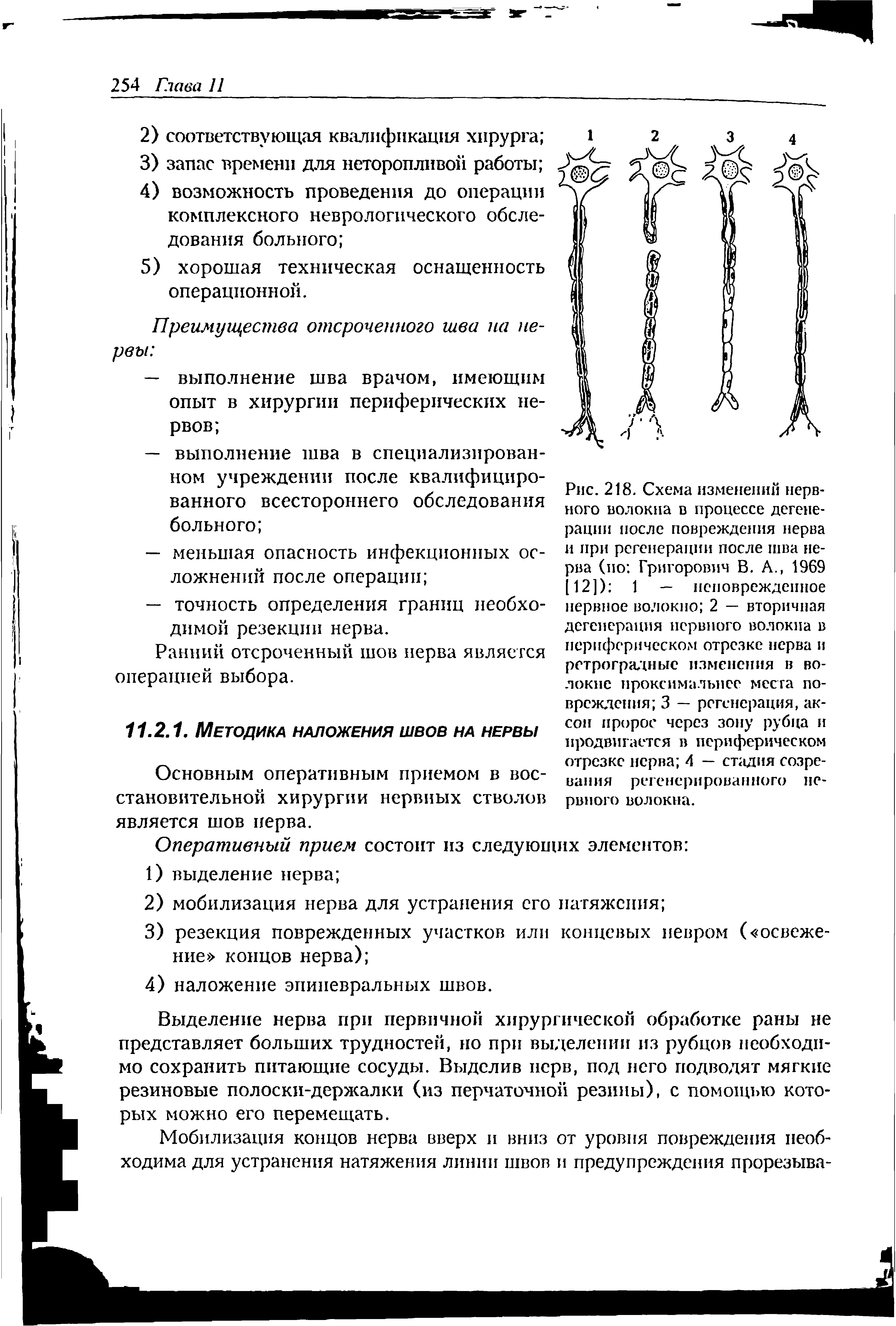 Рис. 218. Схема изменений нервного волокна в процессе дегенерации после повреждения нерва и при регенерации после шва нерва (но Григорович В. А., 1969 [12]) 1 — неповрежденное...