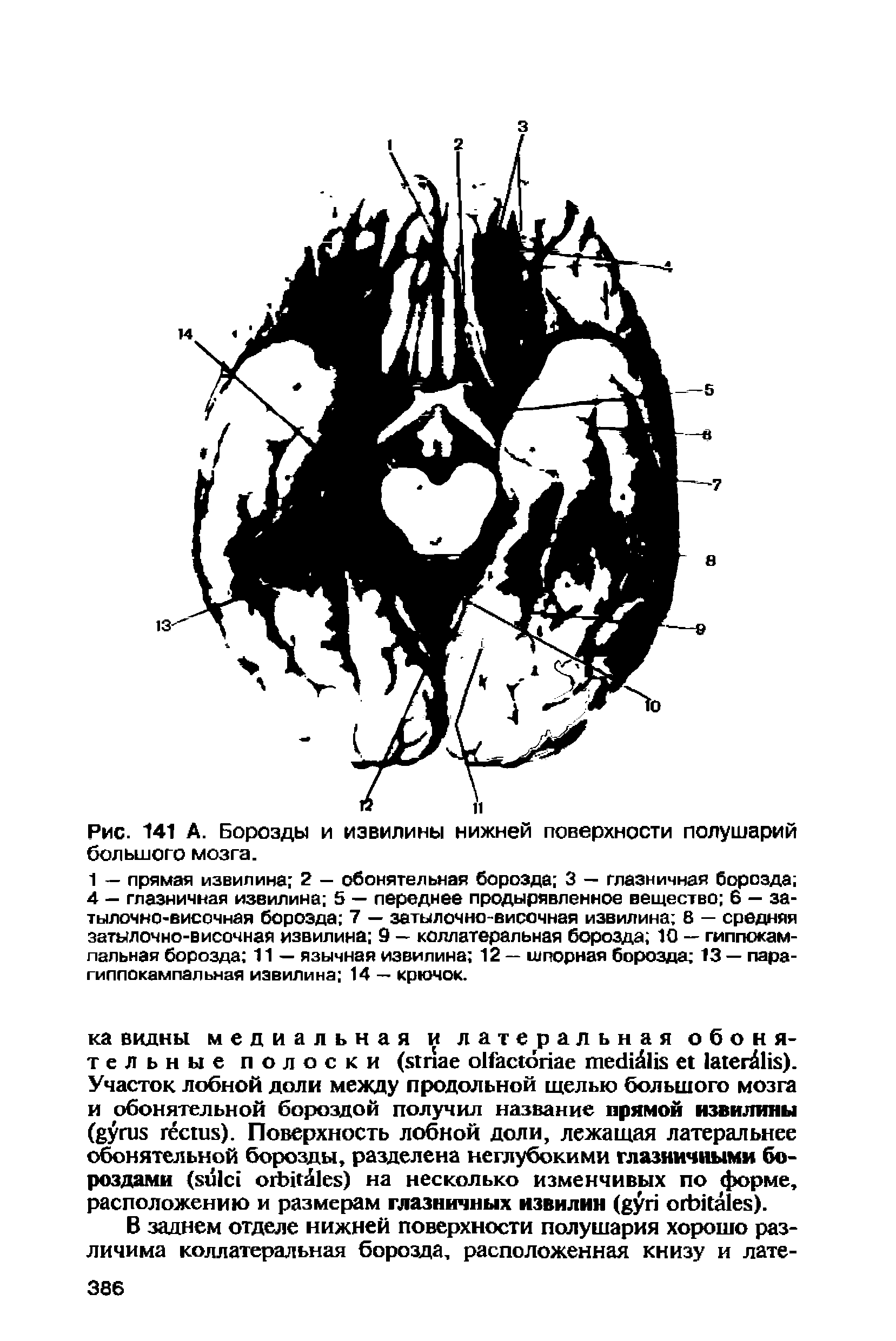 Рис. 141 А. Борозды и извилины нижней поверхности полушарий большого мозга.