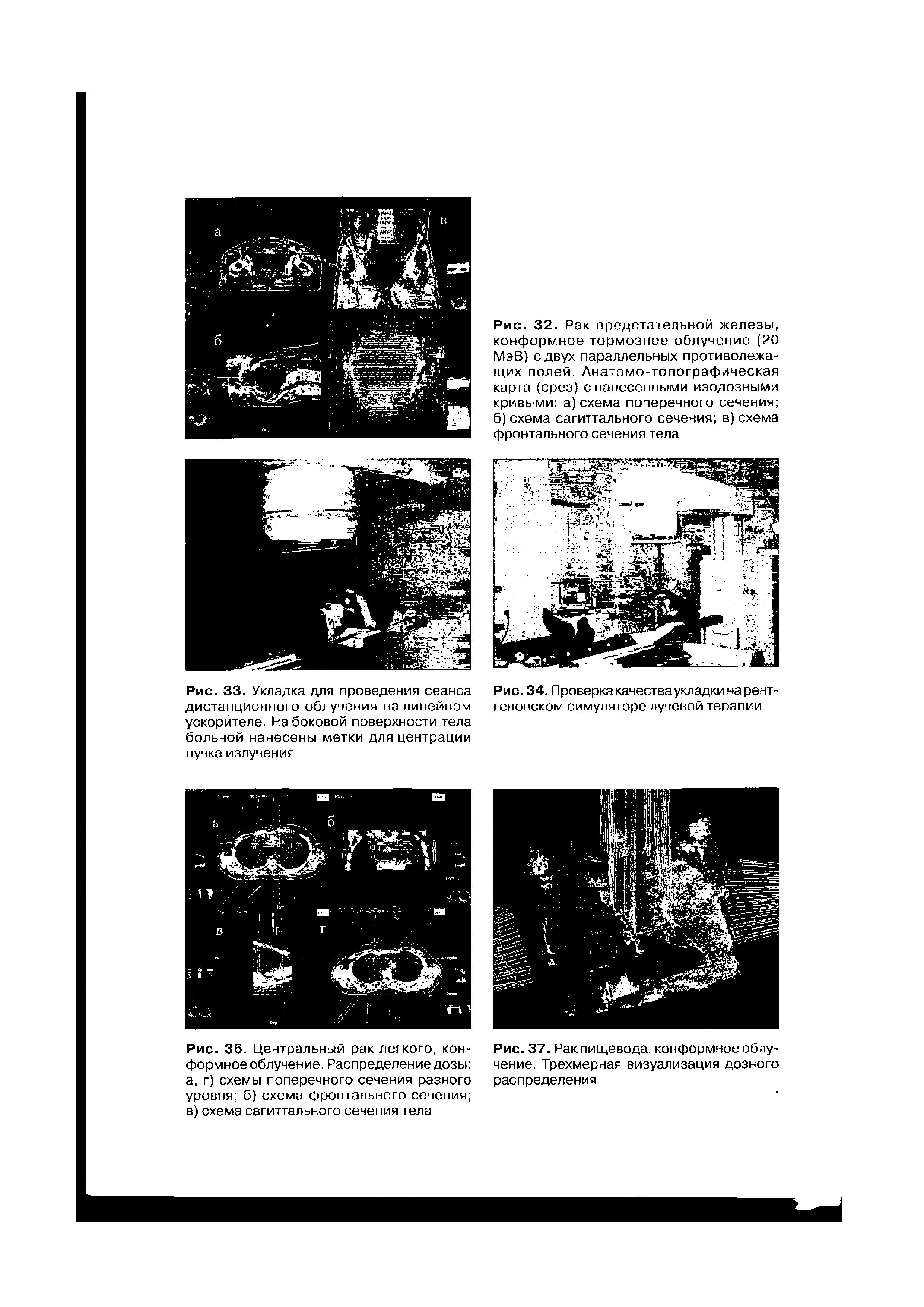 Рис. 34. Проверка качества укладки на рентгеновском симуляторе лучевой терапии...