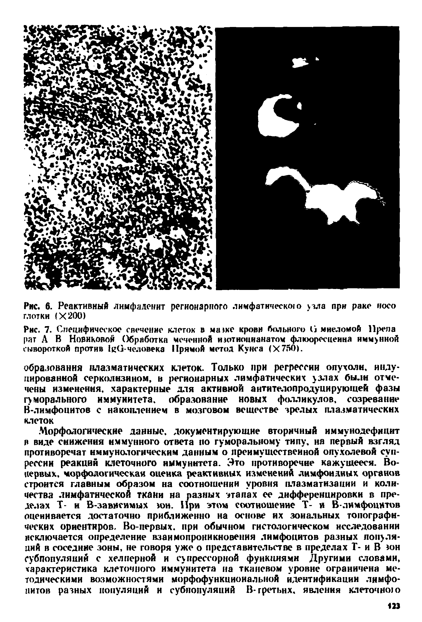 Рис. 7. Специфическое свечение клеток в ма ке крови больного G миеломой Прела рат А В Новиковой Обработка меченной изотиоцианатом флюоресцеина иммунной сывороткой против G-человека Прямой метод Кунса (Х750).