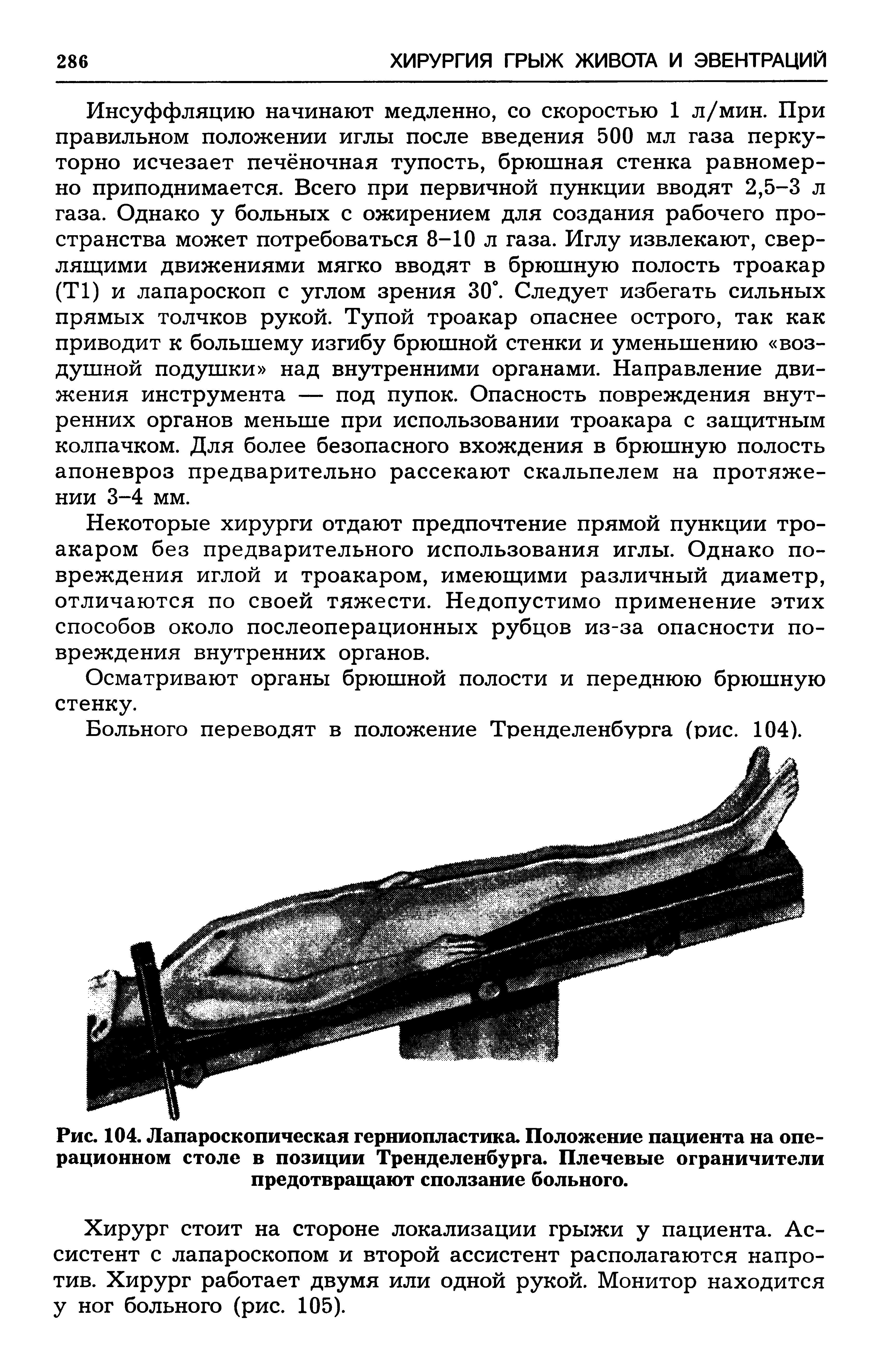 Рис. 104. Лапароскопическая герниопластика. Положение пациента на операционном столе в позиции Тренделенбурга. Плечевые ограничители предотвращают сползание больного.