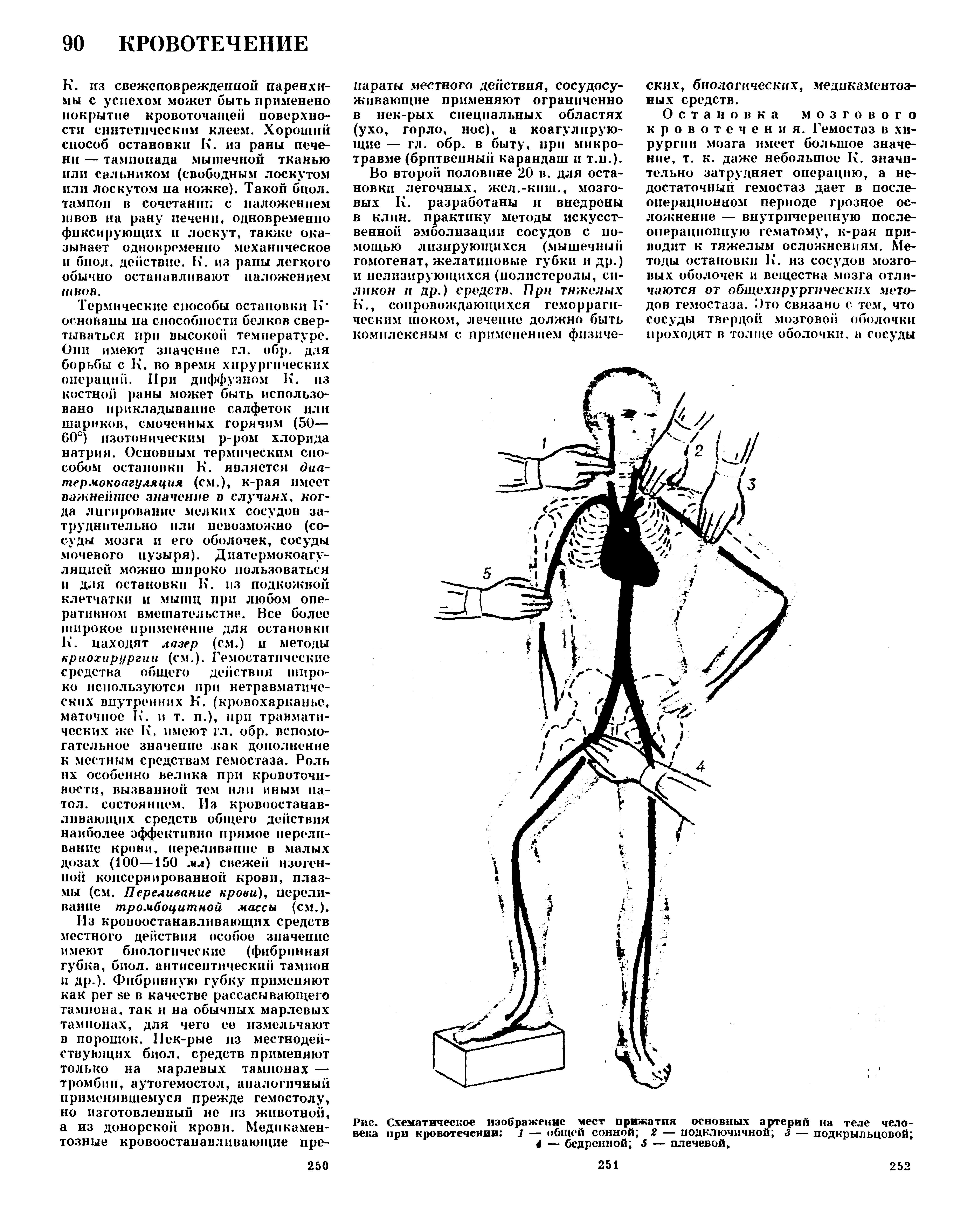 Рис. Схематическое изображение мест прижатия основных артерий на теле человека при кровотечении 1 — общей сонной 2 — подключичной з — подкрыльцовой 4 — бедренной 5 — плечевой.