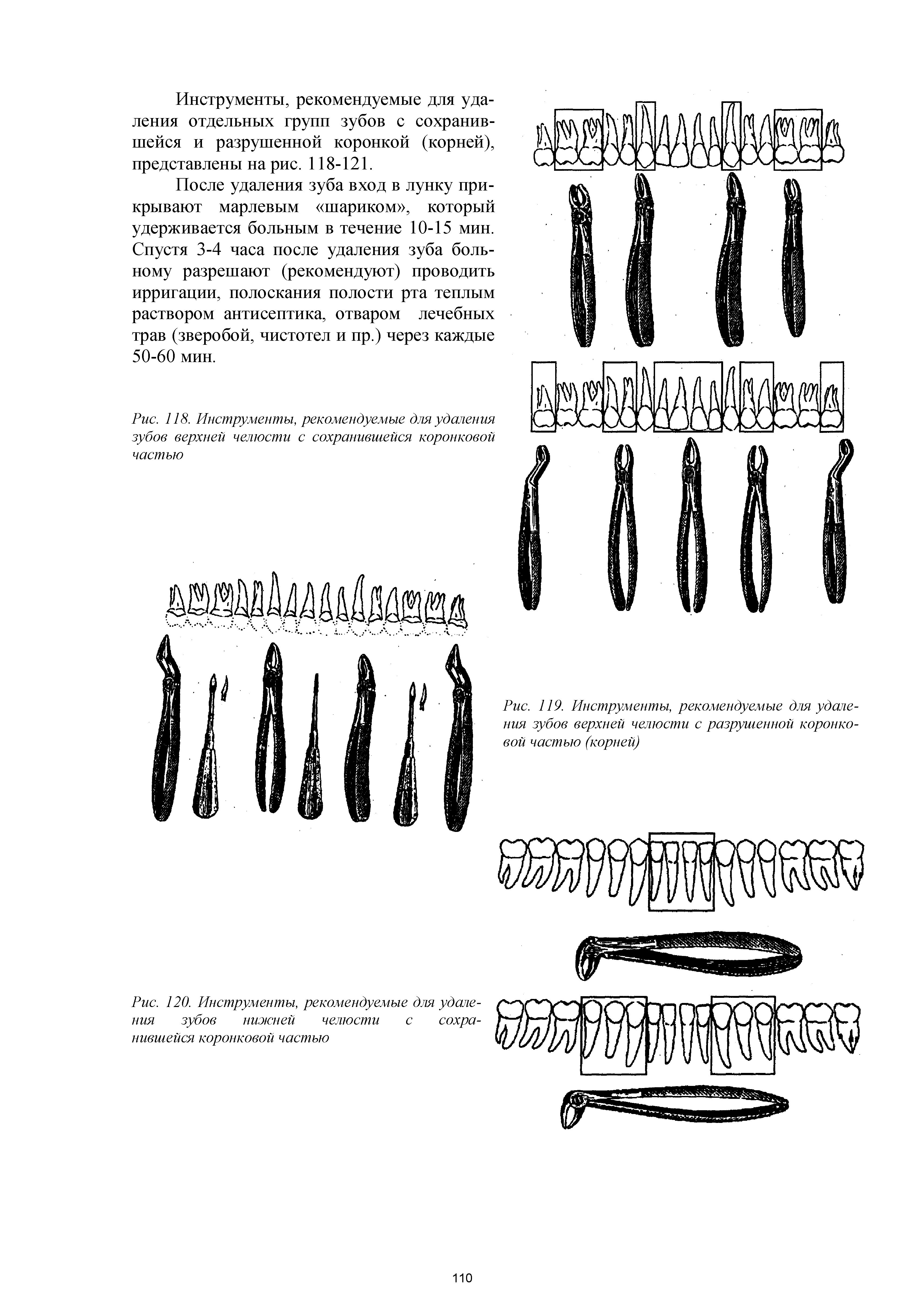 Рис. 120. Инструменты, рекомендуемые для удаления зубов нижней челюсти с сохранившейся коронковой частью...