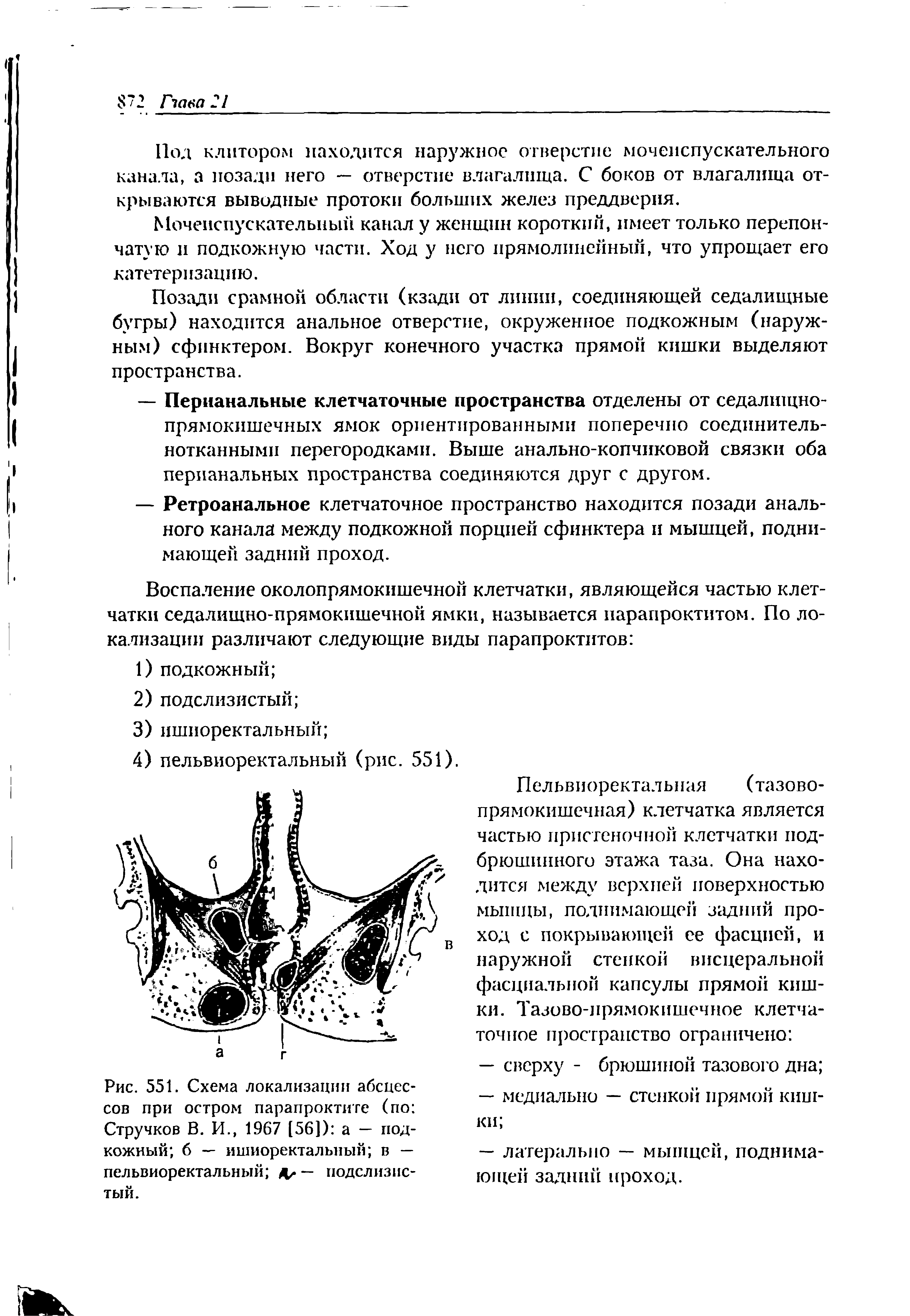 Рис. 551. Схема локализации абсцессов при остром парапроктите (по Стручков В. И., 1967 [56]) а — подкожный б — ишиоректальный в — пельвиоректальный — подслизис-...