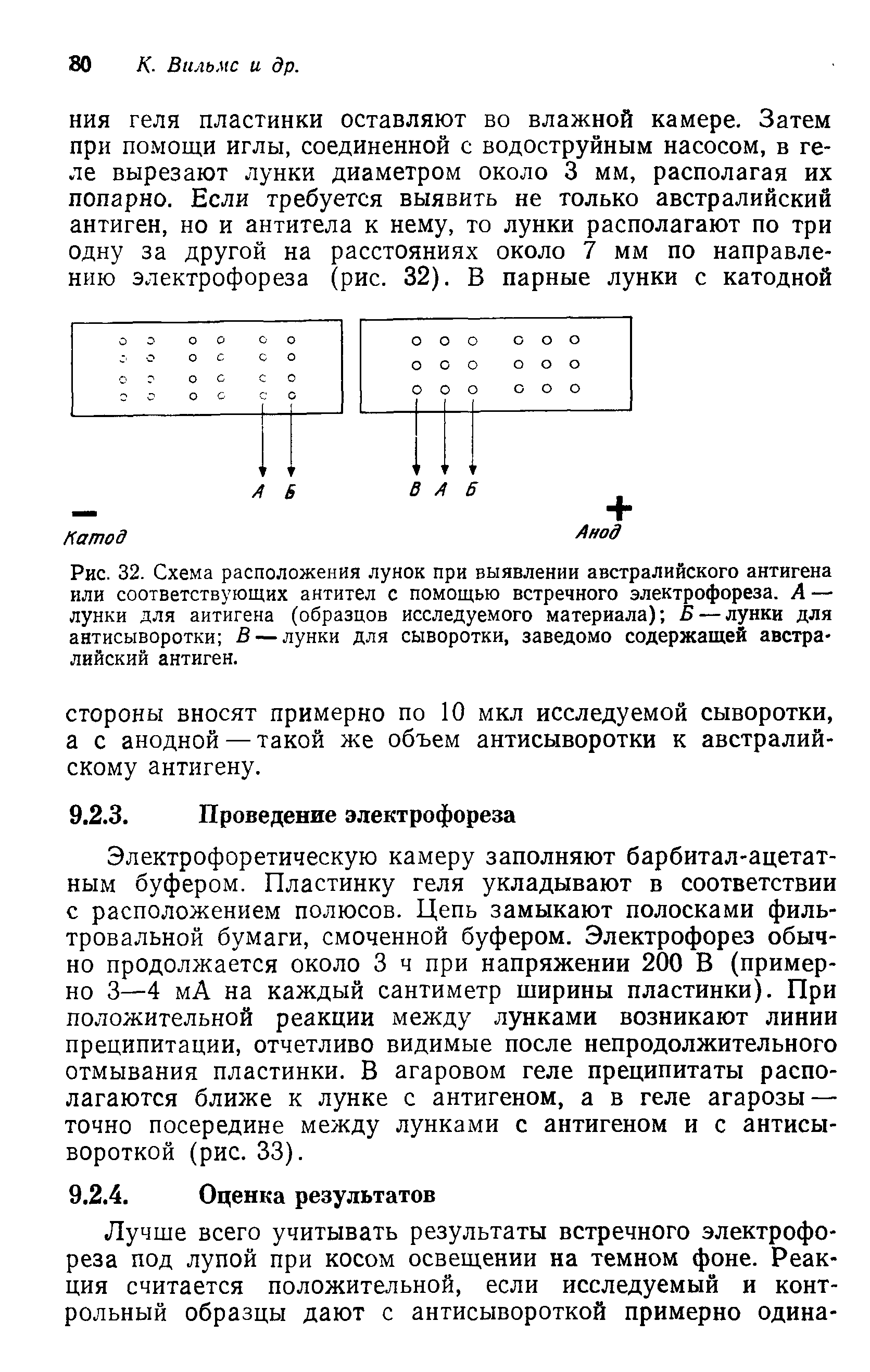 Рис. 32. Схема расположения лунок при выявлении австралийского антигена или соответствующих антител с помощью встречного электрофореза. А — лунки для антигена (образцов исследуемого материала) Б — лунки для антисыворотки В — лунки для сыворотки, заведомо содержащей австралийский антиген.