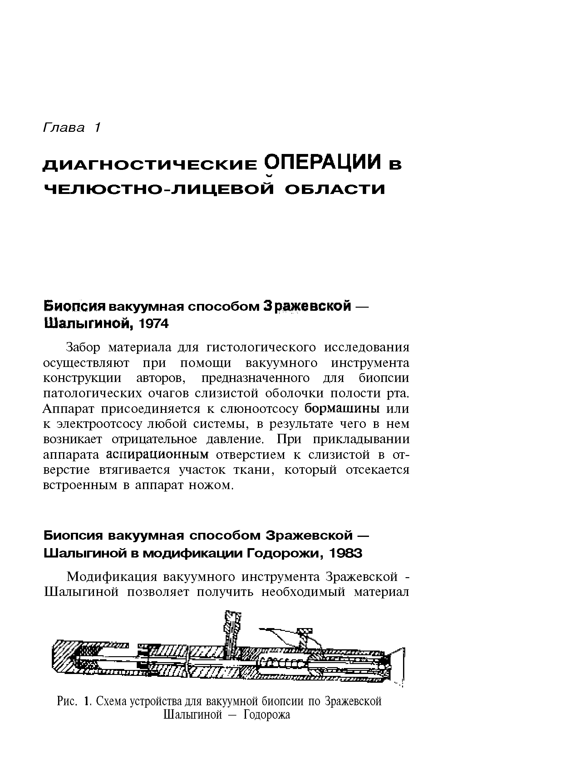 Рис. 1. Схема устройства для вакуумной биопсии по Зражевской Шалыгиной — Годорожа...