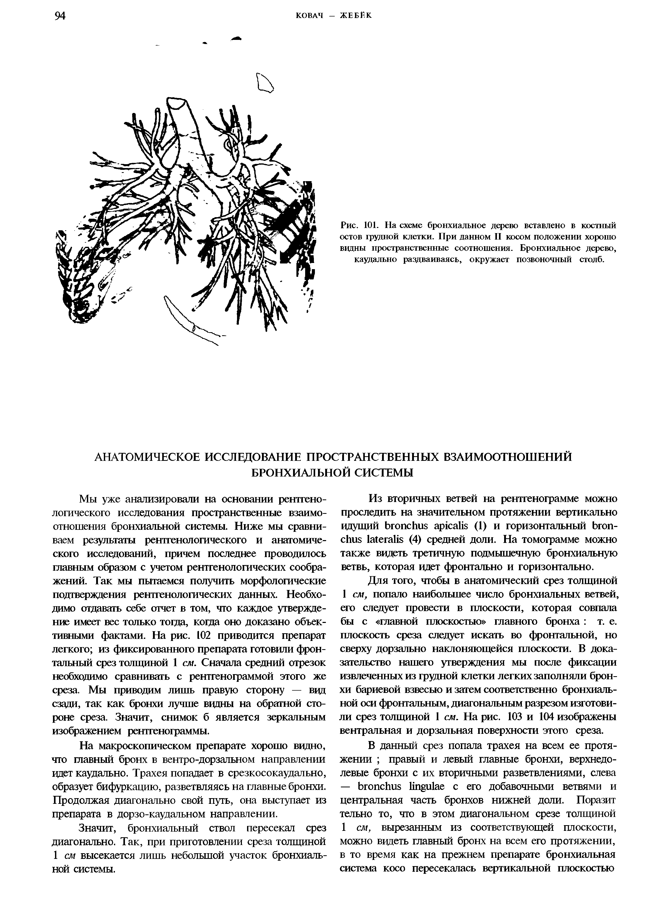 Рис. 101. На схеме бронхиальное дерево вставлено в костный остов грудной клетки. При данном II косом положении хорошо ввдны пространственные соотношения. Бронхиальное дерево, каудально раздваиваясь, окружает позвоночный столб.