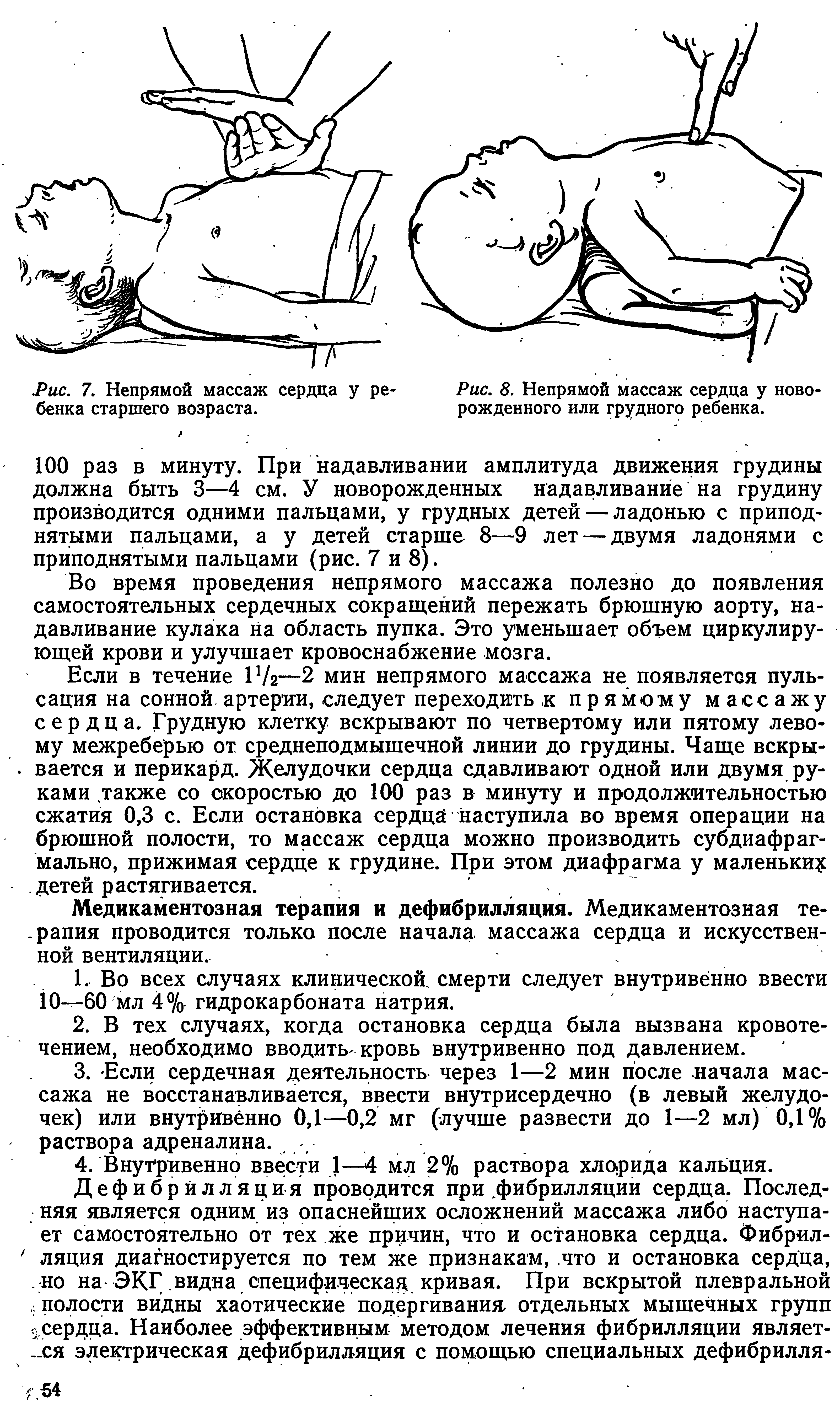 Рис. 7. Непрямой массаж сердца у ребенка старшего возраста.