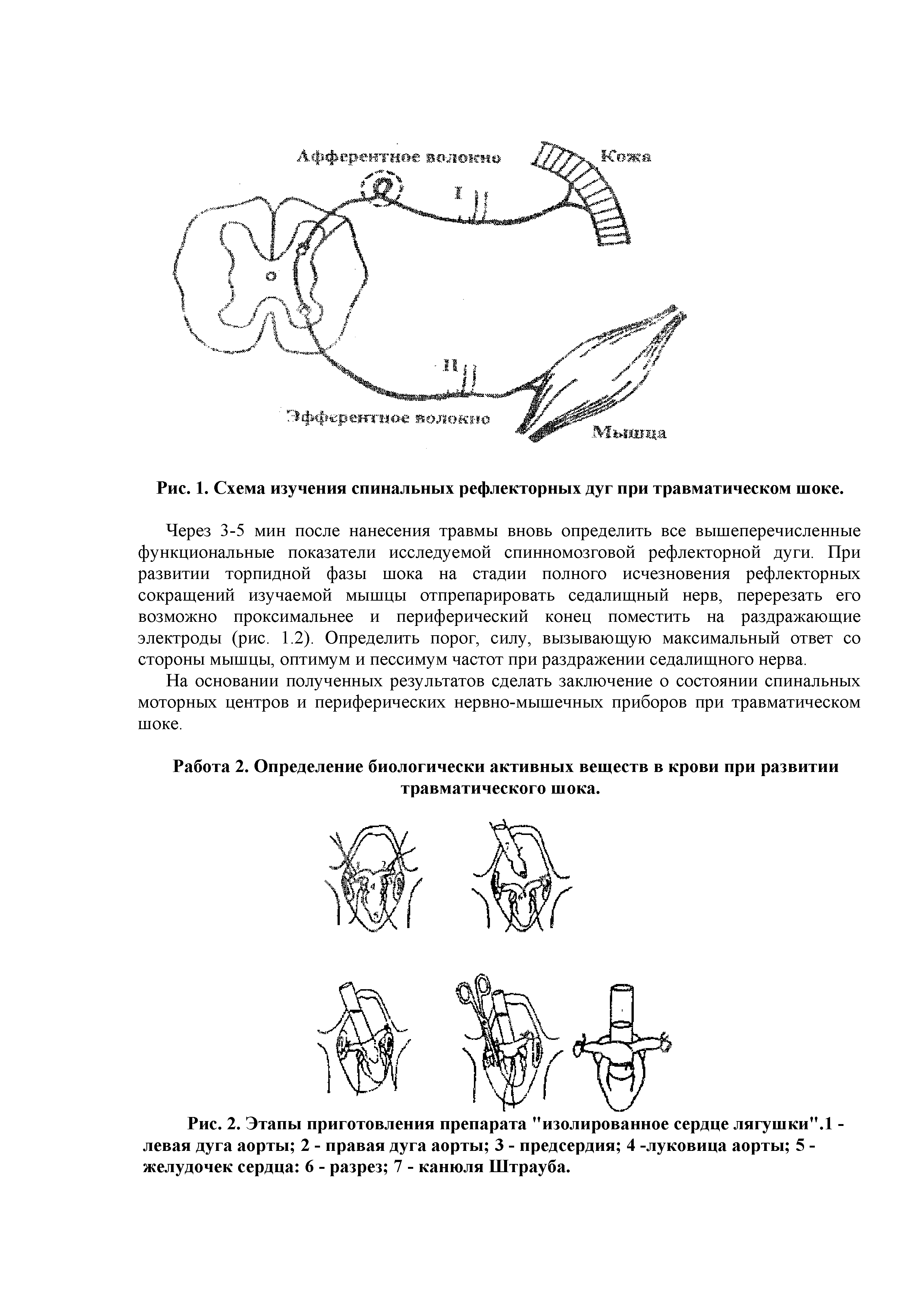 Рис. 2. Этапы приготовления препарата "изолированное сердце лягушки". -...