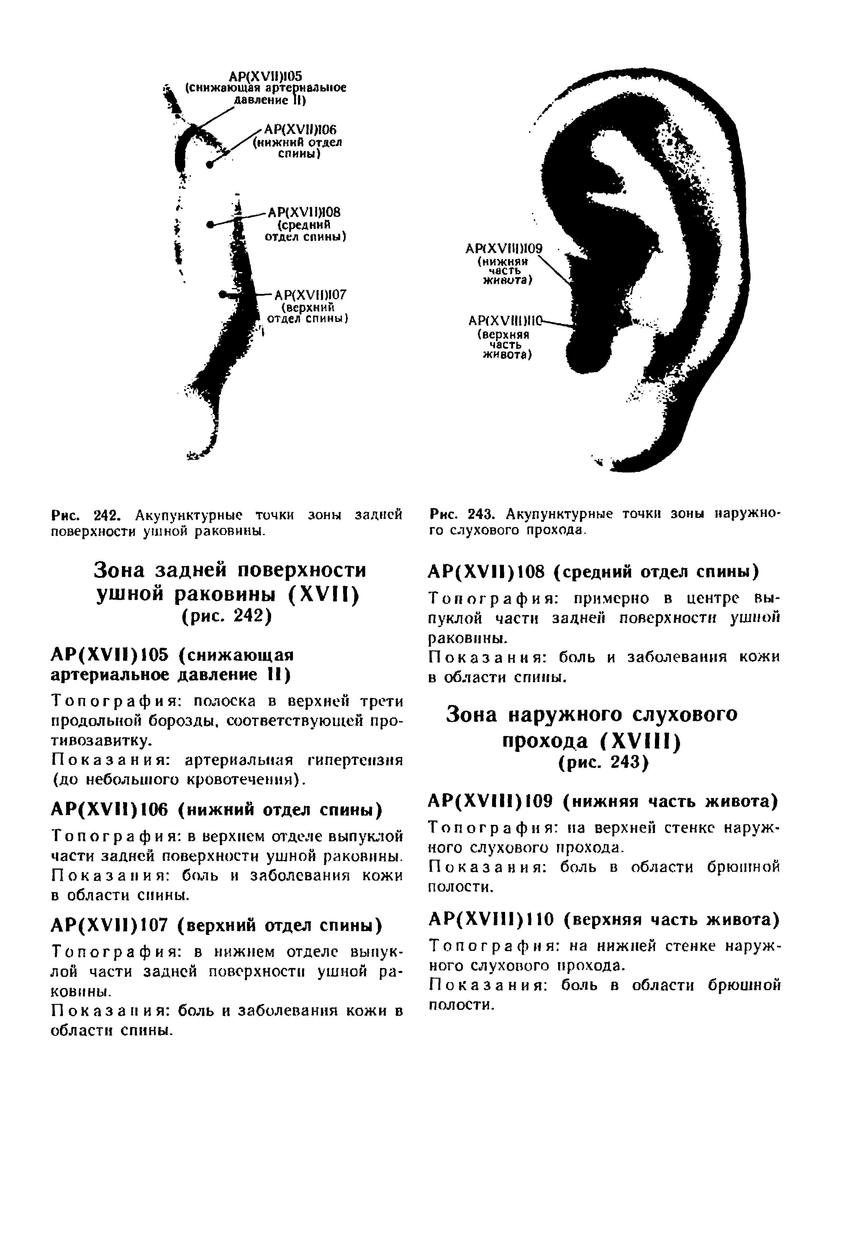 Рис. 243. Акупунктурные точки зоны наружного слухового прохода.