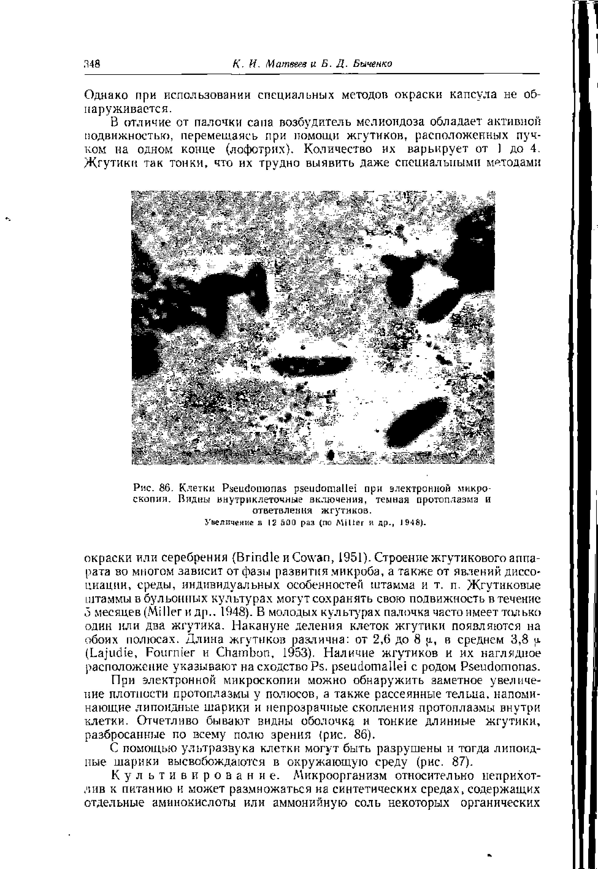 Рис. 86. Клетки P при электронной микроскопии, Видны внутриклеточные включения, темная протоплазма и ответвления жгутиков.