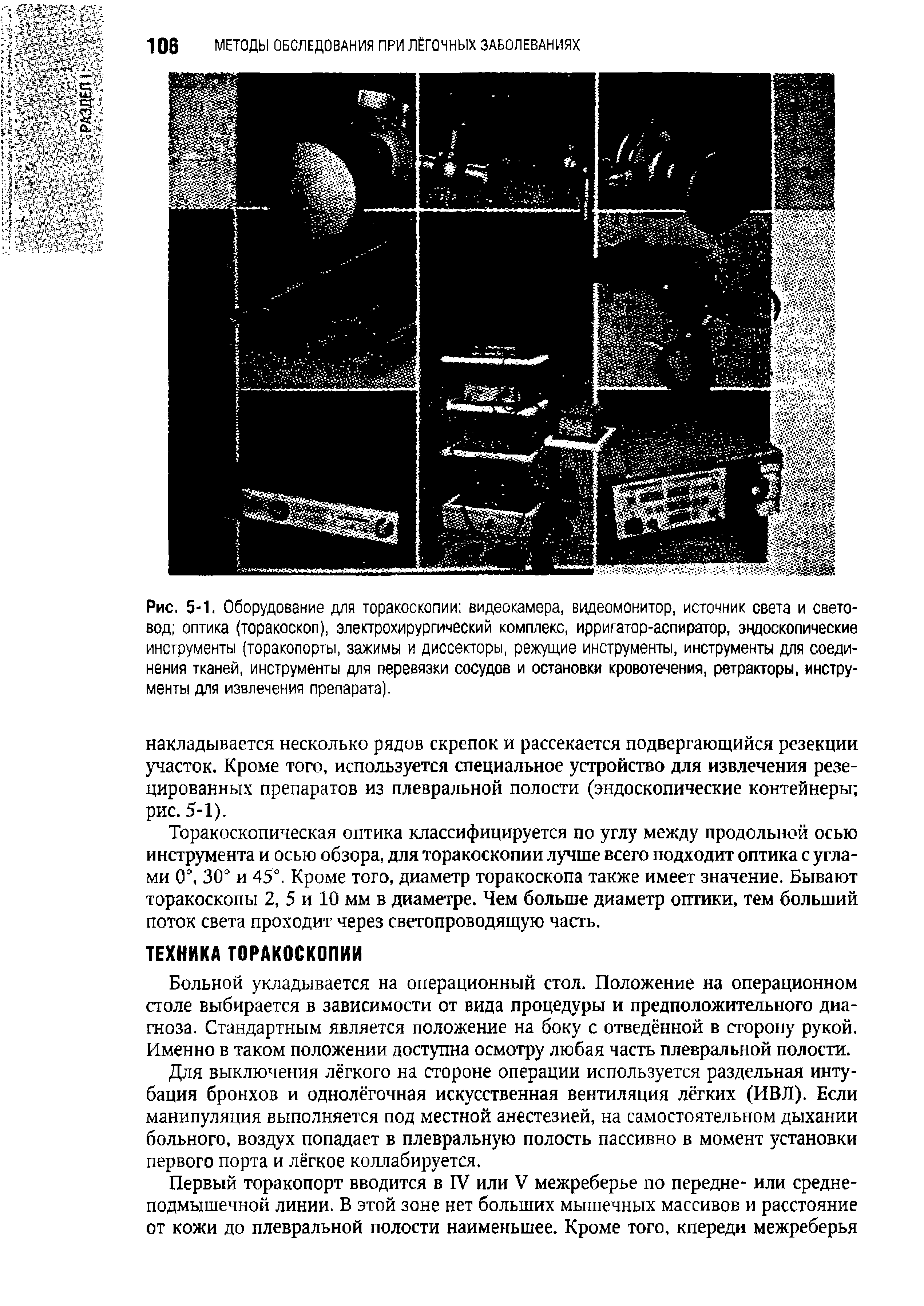 Рис. 5-1. Оборудование для торакоскопии видеокамера, видеомонитор, источник света и световод оптика (торакоскоп), электрохирургический комплекс, ирригатор-аспиратор, эндоскопические инструменты (торакопорты, зажимы и диссекторы, режущие инструменты, инструменты для соединения тканей, инструменты для перевязки сосудов и остановки кровотечения, ретракторы, инструменты для извлечения препарата).