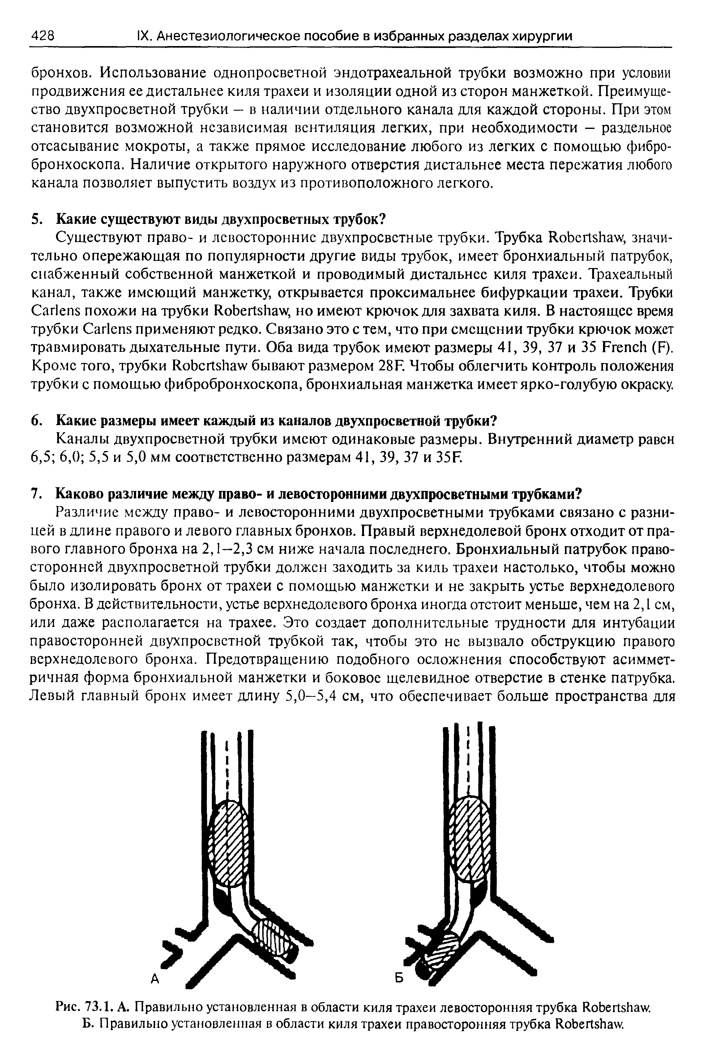 Рис. 73.1. А. Правильно установленная в области киля трахеи левосторонняя трубка R . Б. Правильно установленная в области киля трахеи правосторонняя трубка R .