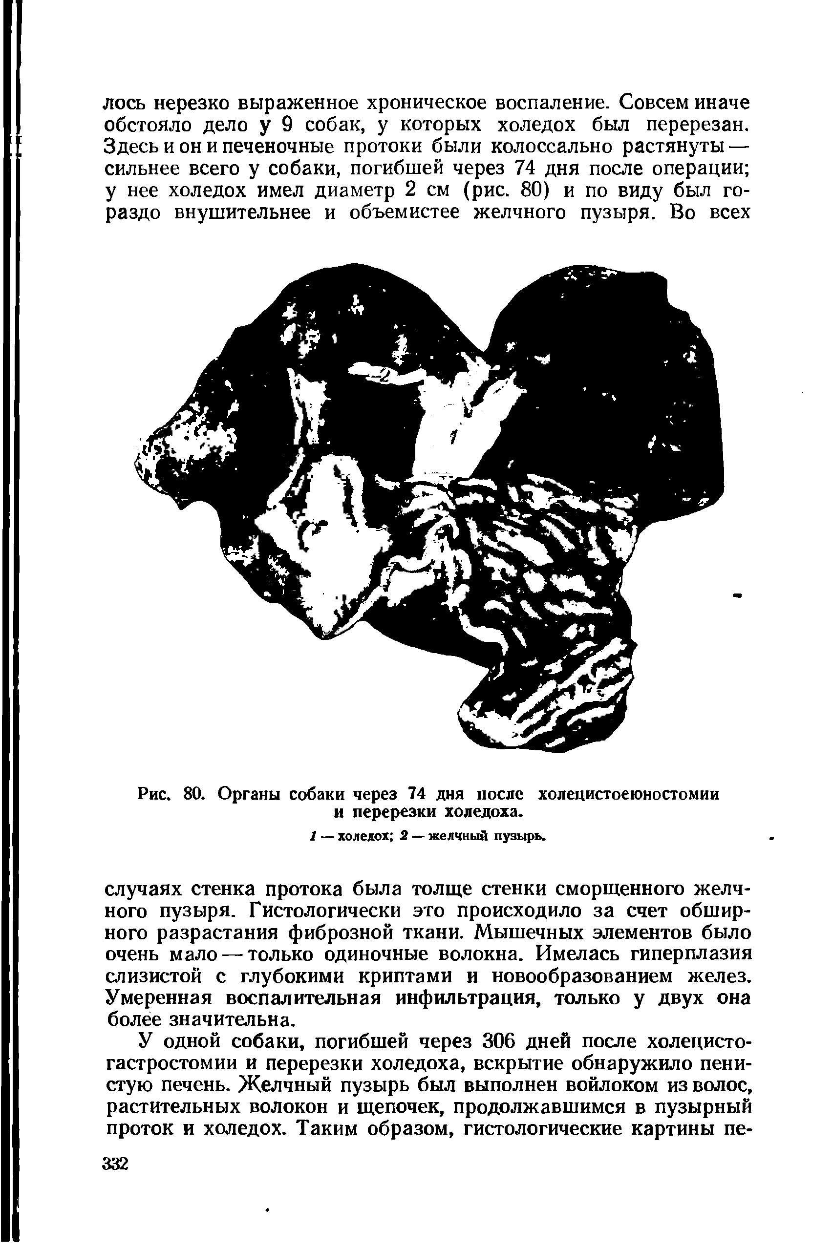 Рис. 80. Органы собаки через 74 дня после холецистоеюностомии и перерезки холедоха.