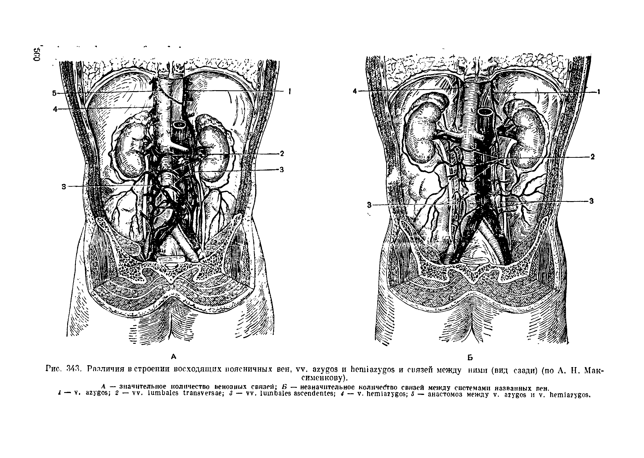 Рис.. 343. Различия в строении восходящих поясничных вен, . и и связен между ними (вид сзади) (по А. Н. Мак-сименкову).