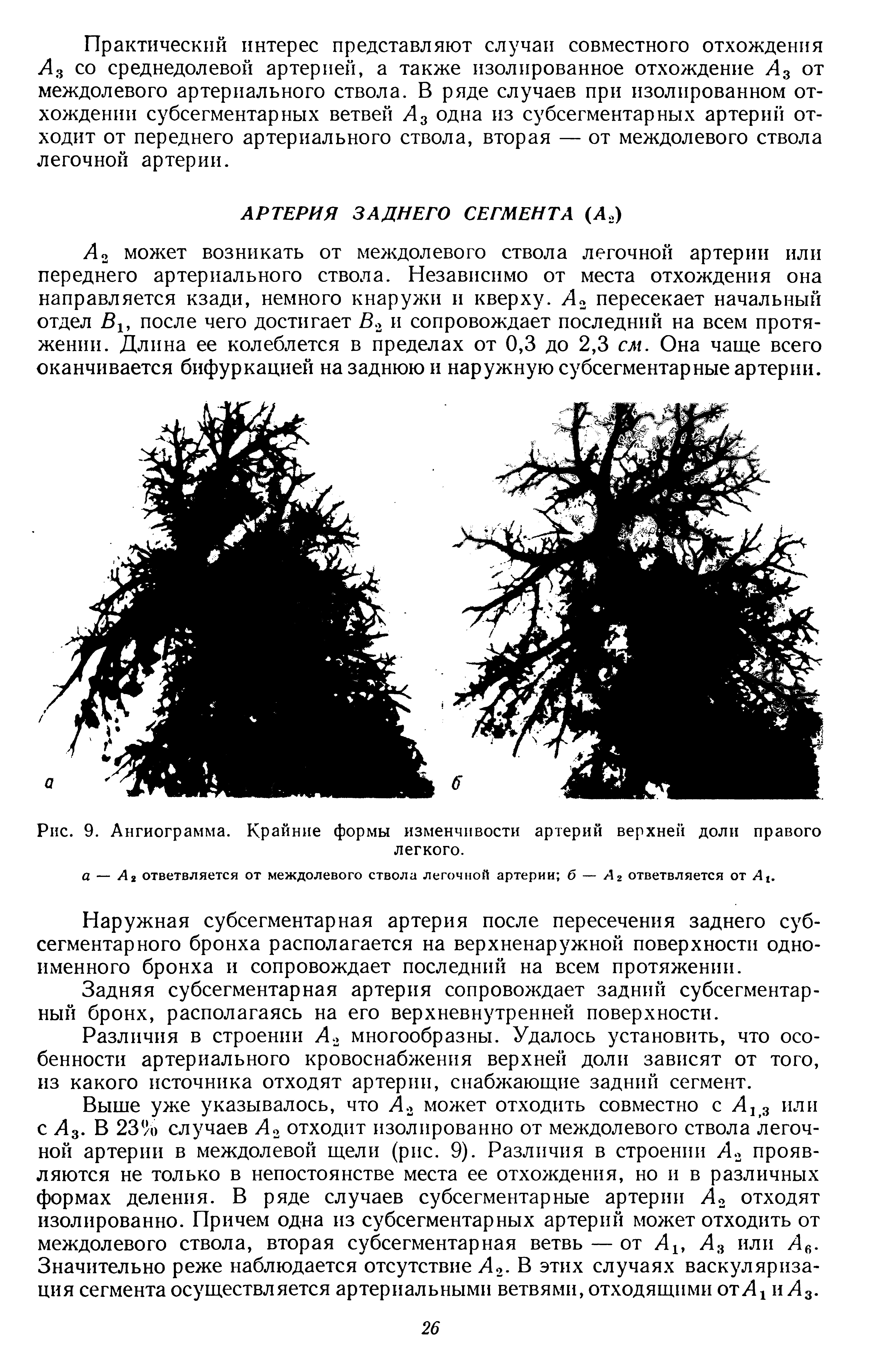 Рис. 9. Ангиограмма. Крайние формы изменчивости артерий верхней доли правого легкого.