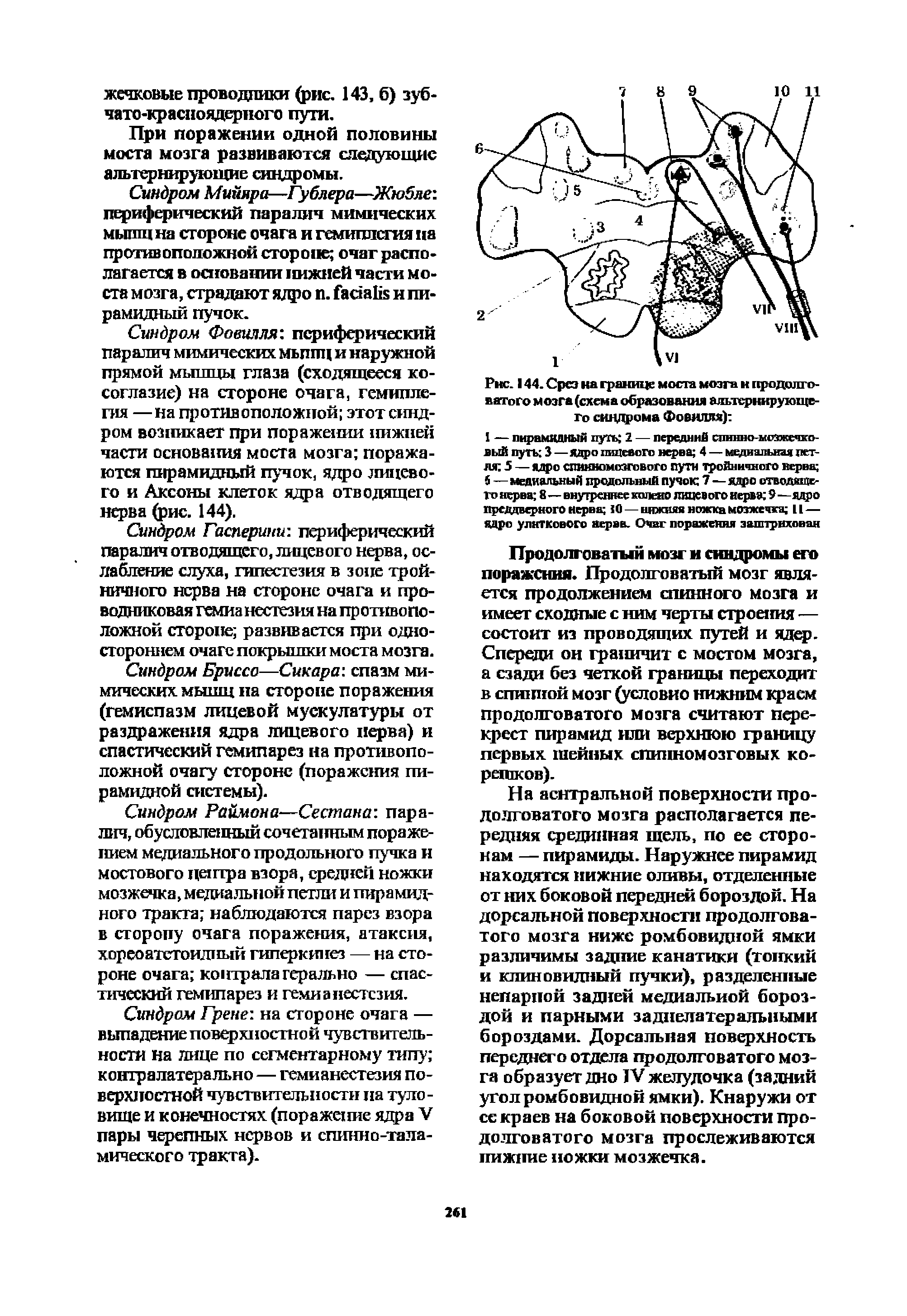 Рис. 144. Срез на границе моста мозга н продолговатого мозга (схема образования альтернирующего синдрома Фовилля) ...